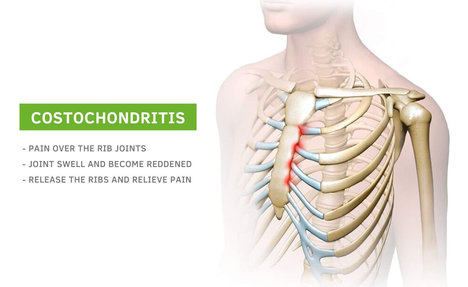 BEIBYE BEIBYE- Upper Back and Headache Pain Relief - treatment for Costochondritis and Tietze Syndromeb-Help Back Stretcher, Posture Corrector