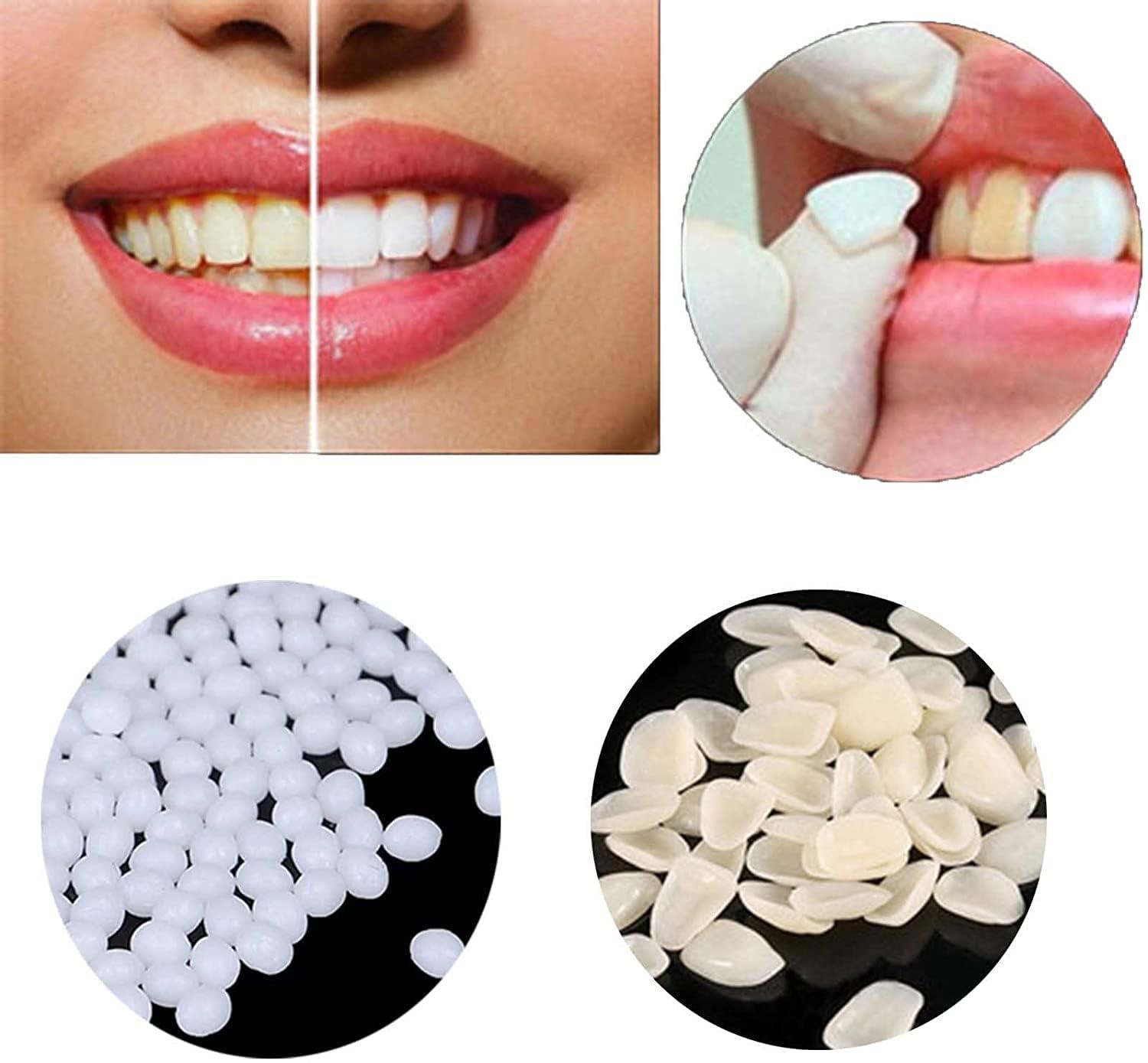 Healthyare Tooth Repair Kit-Thermal Fitting Beads Granules and Fake Teeth for Fixing Missing and Broken Tooth