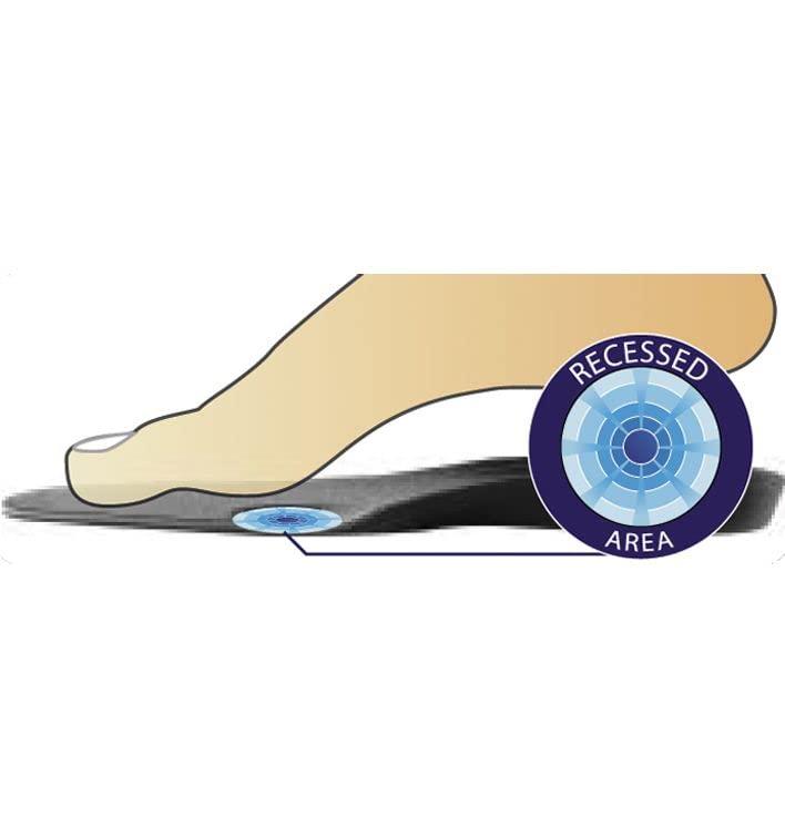 DonJoy DonJoy Arch Rival Orthotic Inserts, 1 Pair, Size B (Shoe Size: Men's 6.5 - 7 / Women's 6.5 - 8)