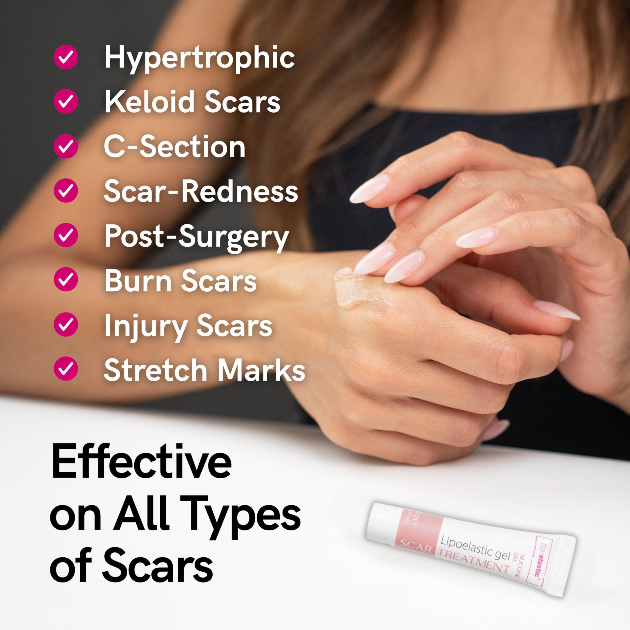 LIPOELASTIC LIPOELASTIC Silicone Scar Cream for Surgical Scars, Medical Grade Silicone Scar Gel with Vitamin E for C-Section, Burn, Stretch Marks, Wound, Old Scar, Acne Scar Treatment, Crema para Cicatrices