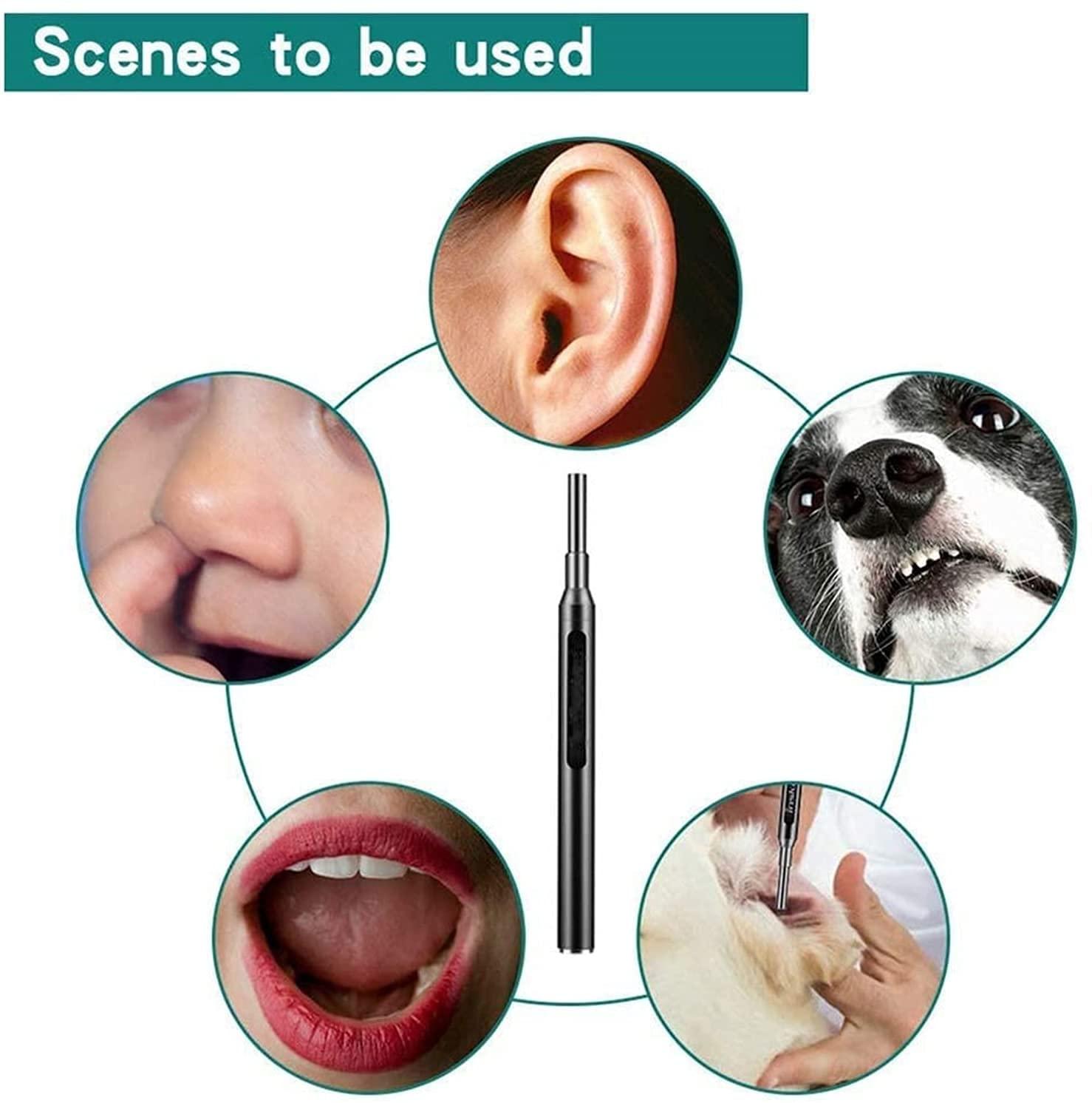 SMSOM SMSOM Ear Wax Removal Tool with Camera,Ear Wax Cleaner Tools with 1080P HD Ear Otoscope,Earwax Cleaner Pick Kit (Black)
