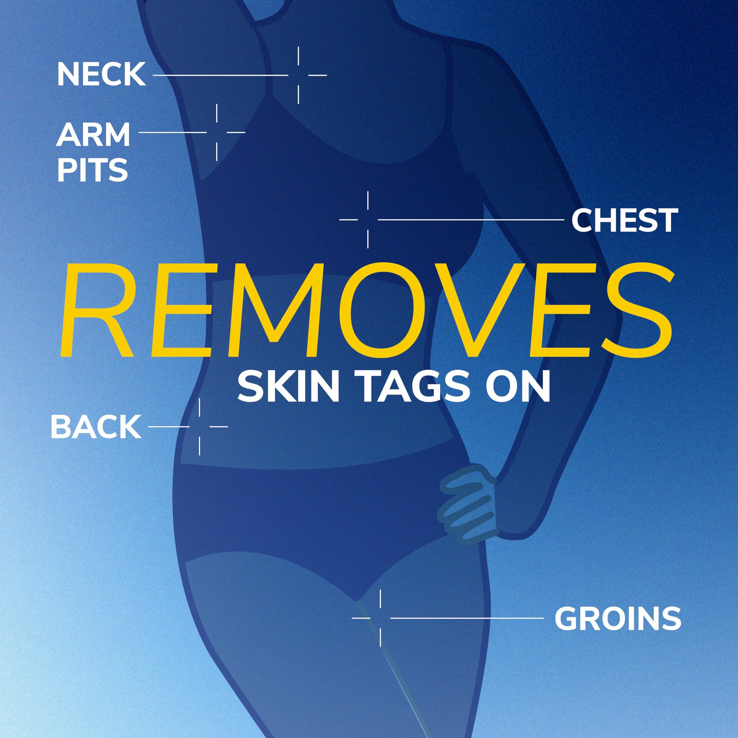 Dr. Scholl's Dr. Scholl's Freeze Away Skin Tag Remover - The First FDA Cleared, at Home Skin tag Removal kit. Clinically Proven Skin tag Removal in as Little as 1 Treatment. 1 Skin tag Removal kit, 8 Treatments.