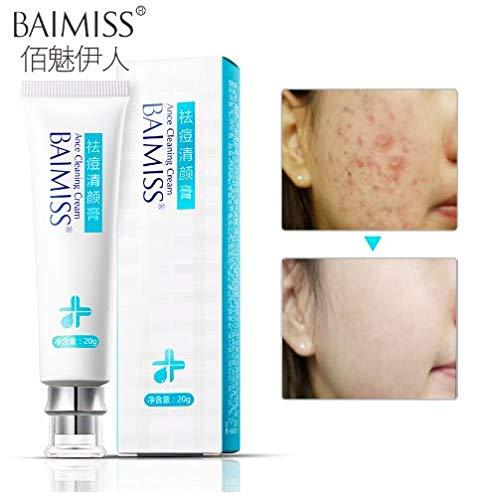 Tink knub BAIMISS Herbal Acne Treatment Cream 1PCS Remove Acne Scar Pimple Face Cream Skin Care Acne Send Removal Needle