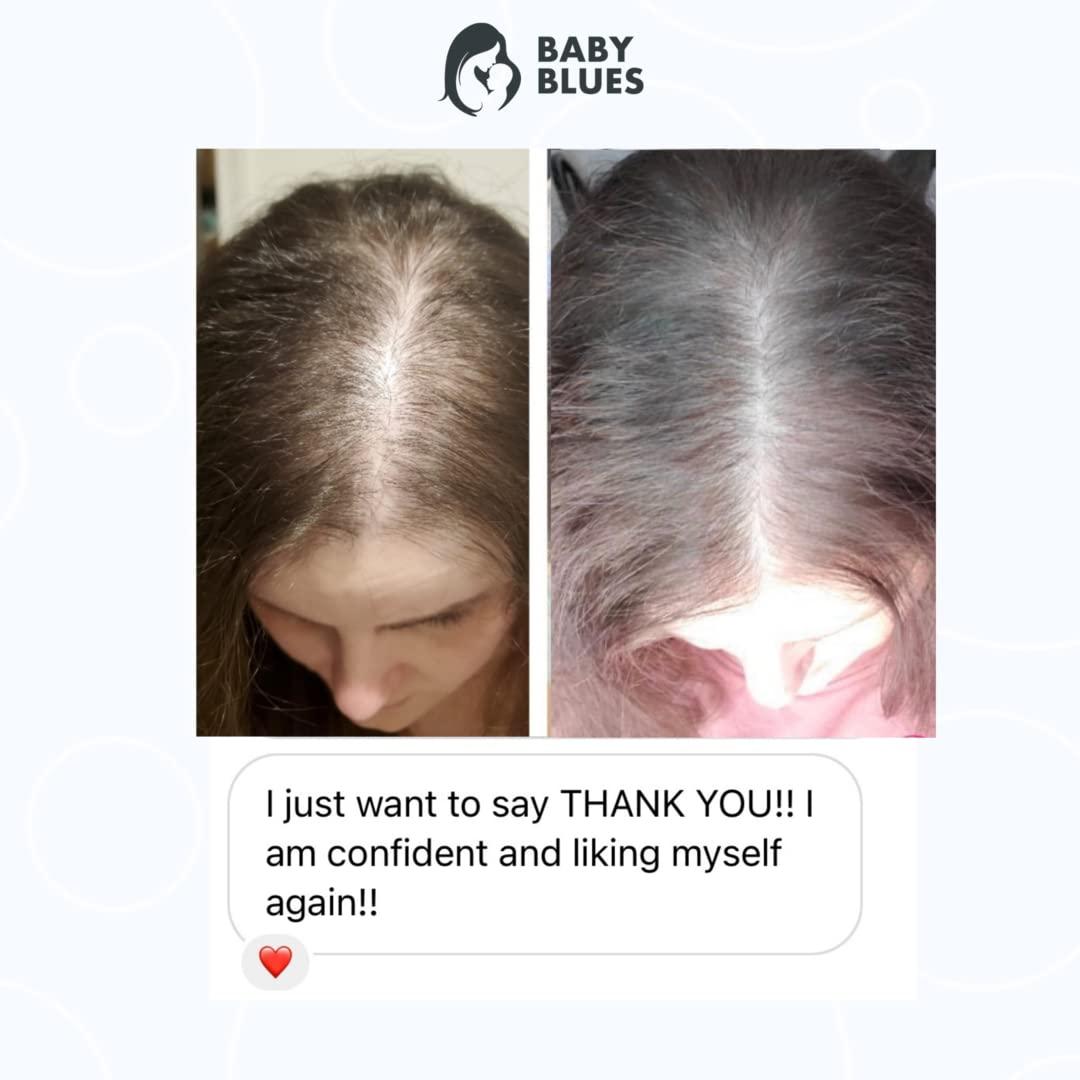 Baby Blues Baby Blues Postpartum Hair Loss Vitamins - Full Hair Cycle Pack - with Biotin, Collagen, & Folate