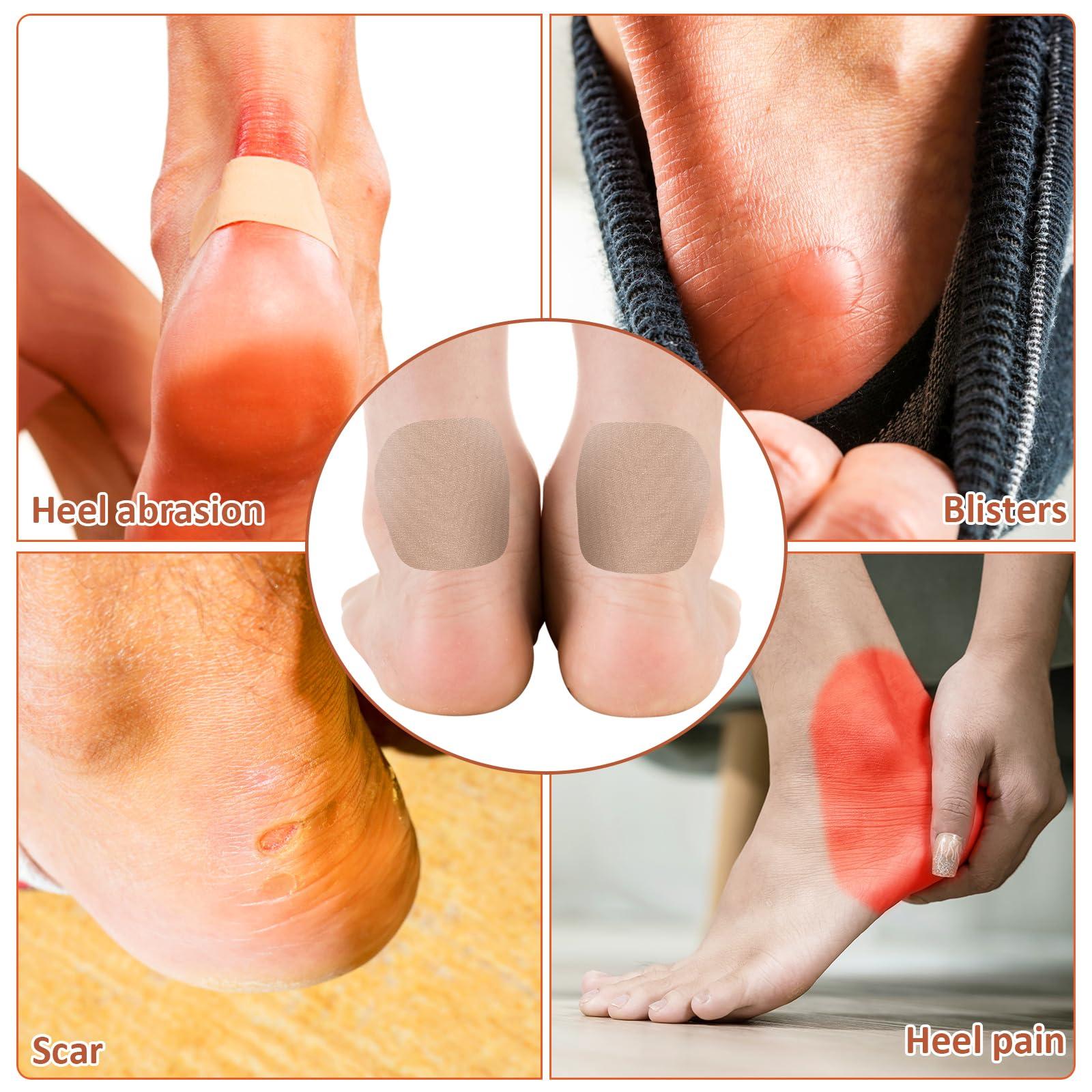 COMNICO COMNICO Moleskin Adhesive Pads, Blister Prevention Tape Moleskin Padding Patch Reduce Friction for Feet Toes Heel Shoes Boots Hiking - 5 Sheets (20 Pieces Total)