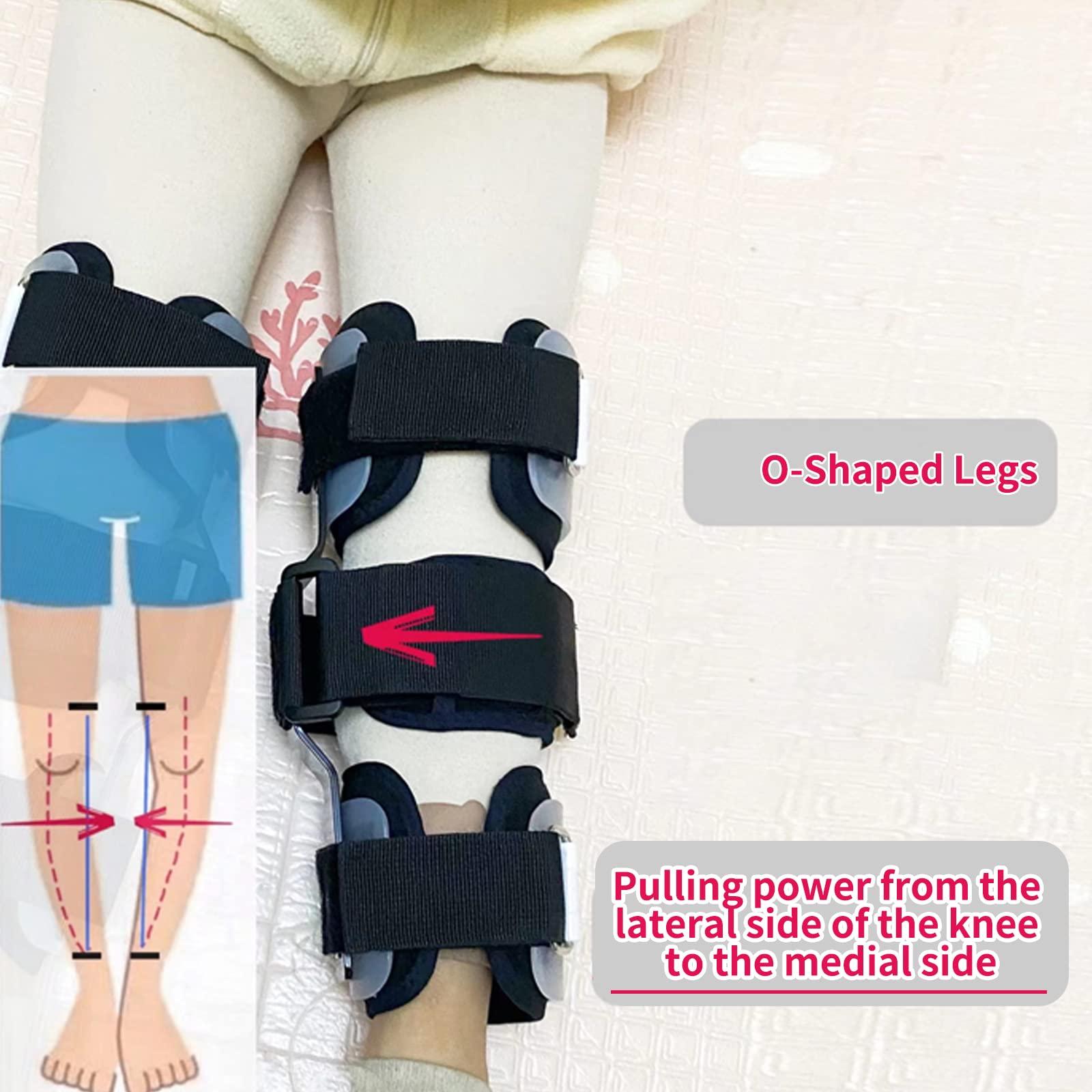 Shuyan Jiao Shuyan Jiao O/X Leg Type Correction Belt Pediatric Kids Leg Posture Corrector Brace for Children Knees Valgus Straighten Belt Lightweight Medical O/X Legs Type Bandage (M -1 Pair)