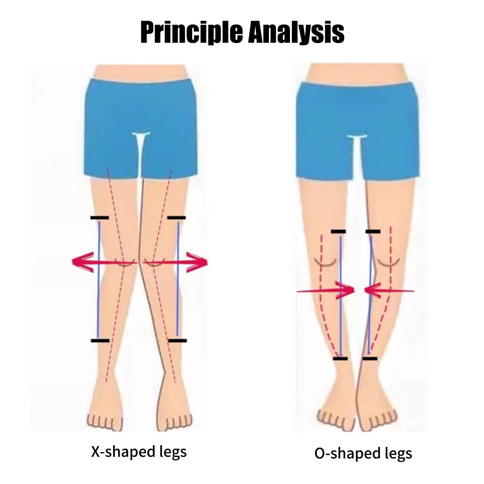 Shuyan Jiao Shuyan Jiao O/X Leg Type Correction Belt Pediatric Kids Leg Posture Corrector Brace for Children Knees Valgus Straighten Belt Lightweight Medical O/X Legs Type Bandage (M -1 Pair)