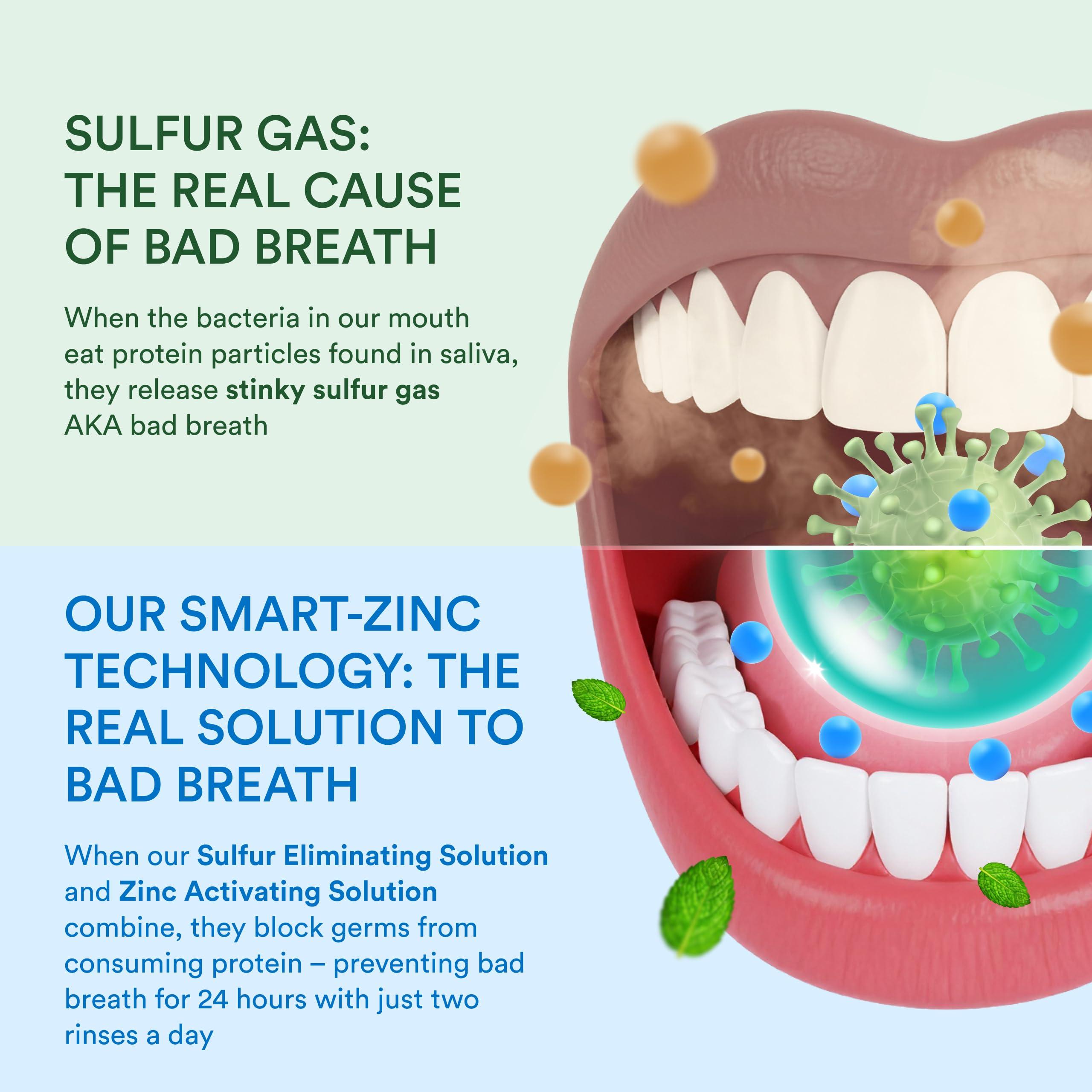 SmartMouth SmartMouth Clinical DDS Activated Oral Rinse and Premium Toothpaste for 24 Hour Bad Breath Prevention and Maximum Gingivitis and Bleeding Gums Protection