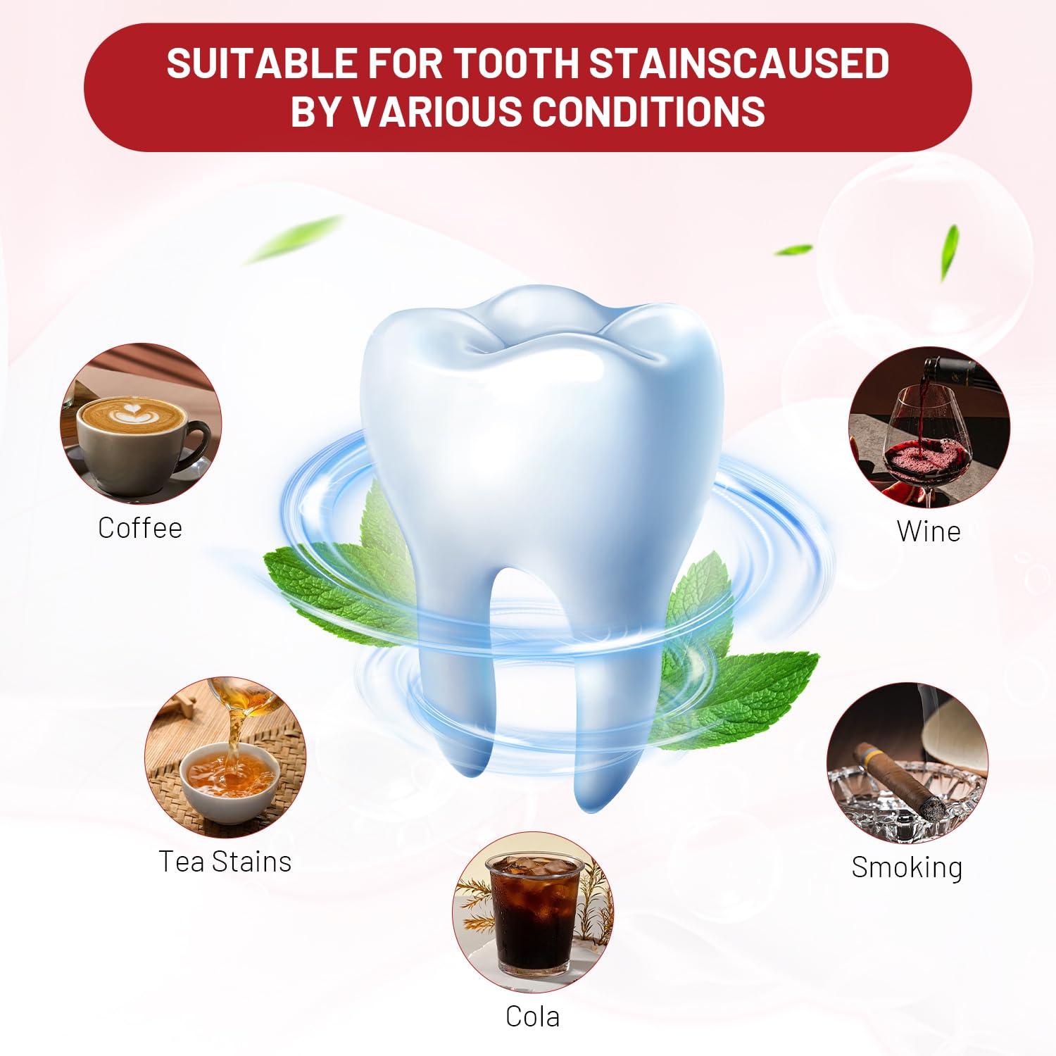 Mrryiio Sp10 Probiotic Toothpaste,Sp-10 Ultra Whitening Toothpaste,Probiotics Bright White Toothpaste,Sp-10 Probiotic Toothpaste,Sp10 Toothpaste,Fresh Breath,Deep Cleaning Care Toothpaste2Pcs