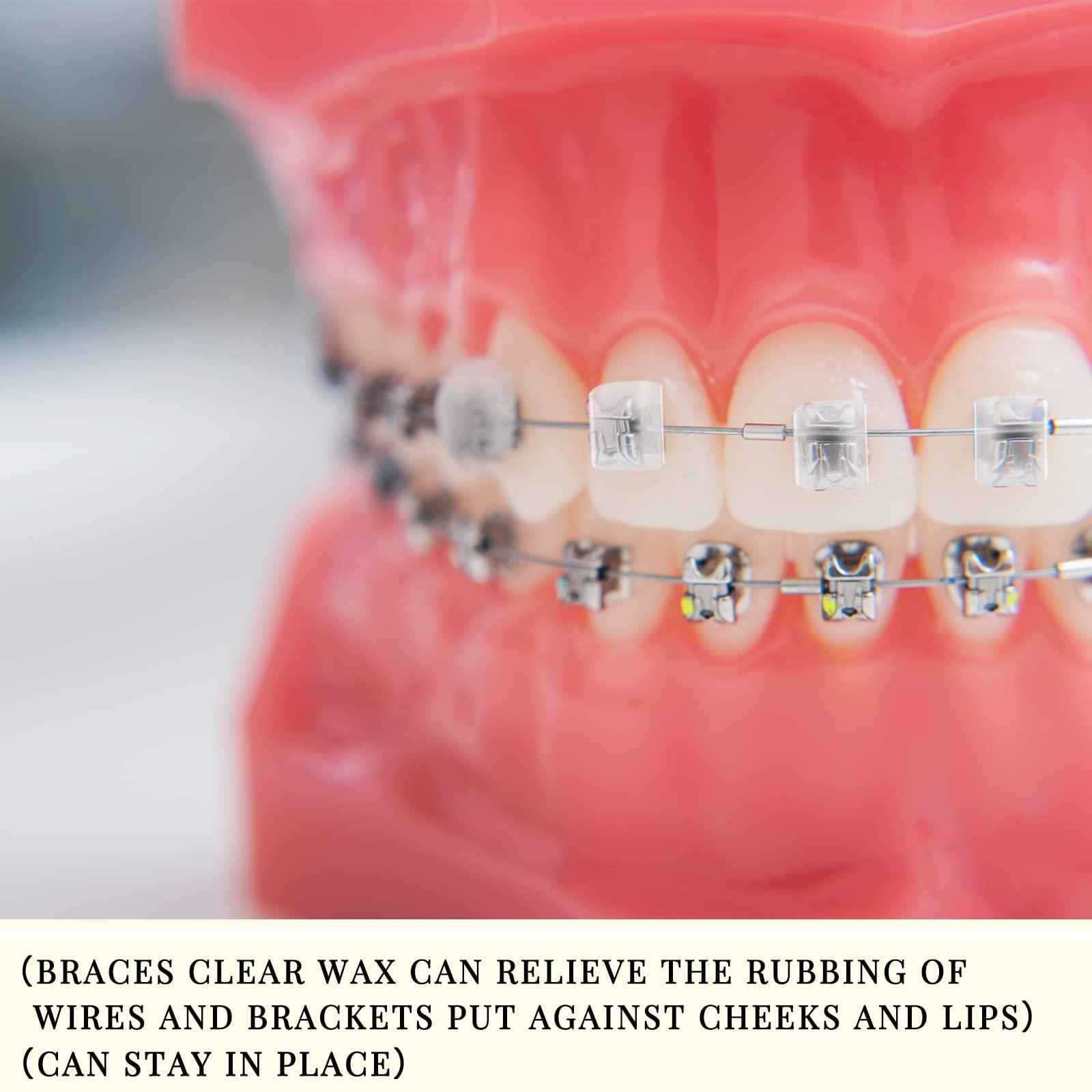 Sinmoe Sinmoe 40 Pack Dental Wax for Braces Orthodontic Wax for Teeth Oral Appliances with Colorful Storage Case and Small Plastic Cutter Repair Kit for Dental Care Wearer Braces Brackets