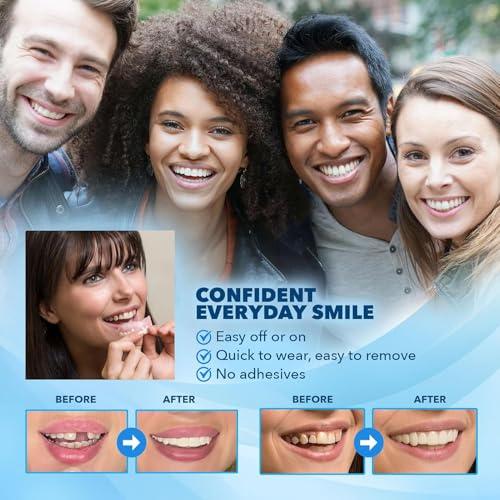 HYZX Upper and Lower Veneer, Dentures for Women and Men, Fake Teeth, Natural Shade! Fix Your Smile at Home Within Minutes!