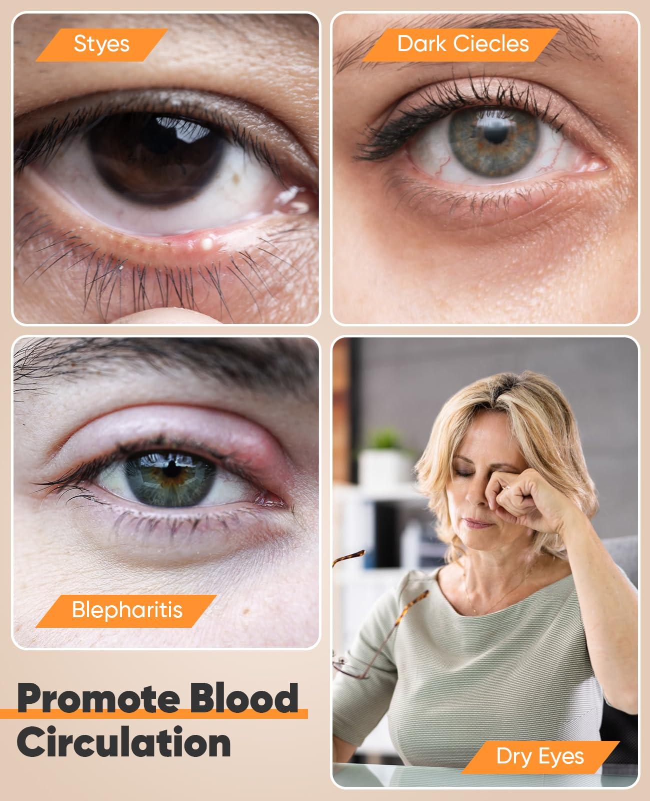 Telepepe Heated Eye Mask for Dry Eyes, Cordless Warm Eye Compress, Blepharitis, Styes, 1000mAh, Washable Cover, Gifts for Family and Friends, Travel (Purple)