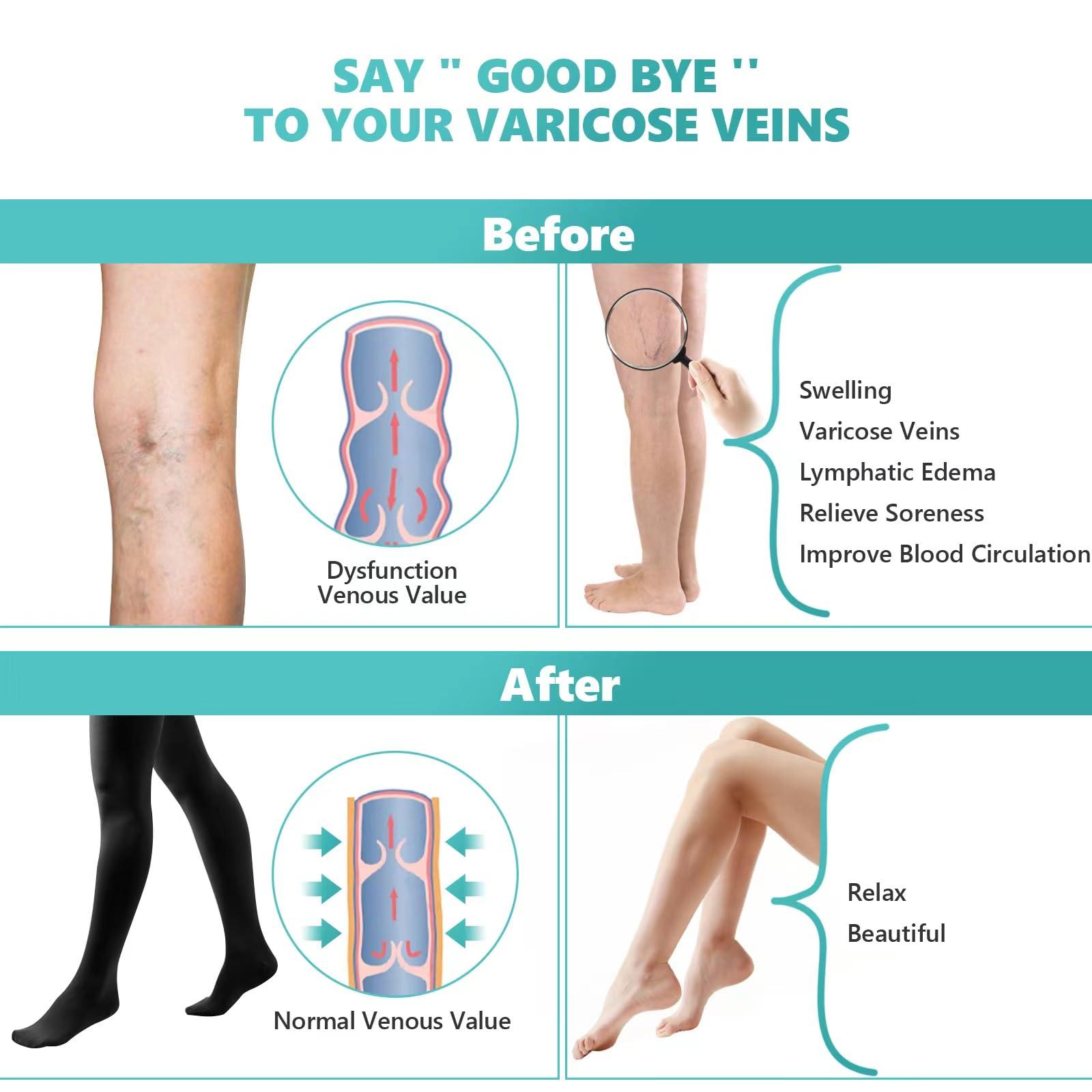 Orgood Orgood Compression Pantyhose for Women, 20-30mmHg Graduated Compression Stockings & Leggings, Closed Toe Support Hose Tights for Varicose Veins, Edema, Flight, DVT