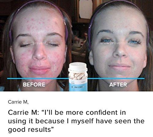 Onecare Wellness Praventac & Ag-Factor 1-month package Reduce Acne, Pimple, Blemishes, Treat Scar (1 bottle each/60 capsule per bottle)