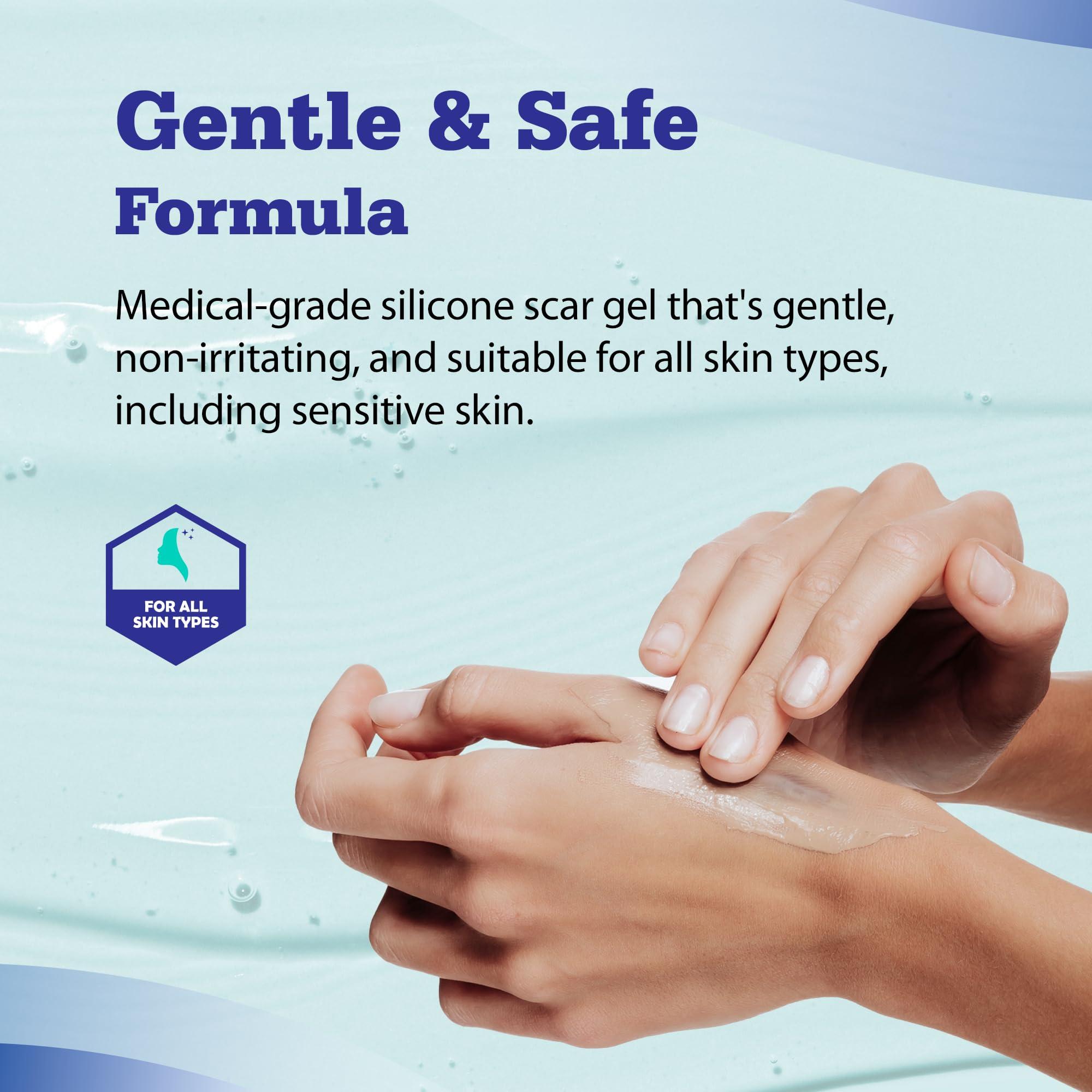 Aroamas Scar Aroamas Scar Advanced Scar Gel - Medical-Grade Silicone Scar Gel for Surgical Scars, for Face, Scar gel with silicone for Keloids, C-Section, Cosmetic Procedures, Burns, Injuries - 45g