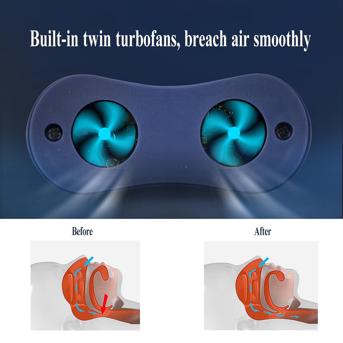 NineLife Basics Micro Device for Sleep Apnea,Electric Snore Stopper, Anti Snoring Devices,Snoring Solution Suit for Adults,Built-in Twin turbofans (Blue)