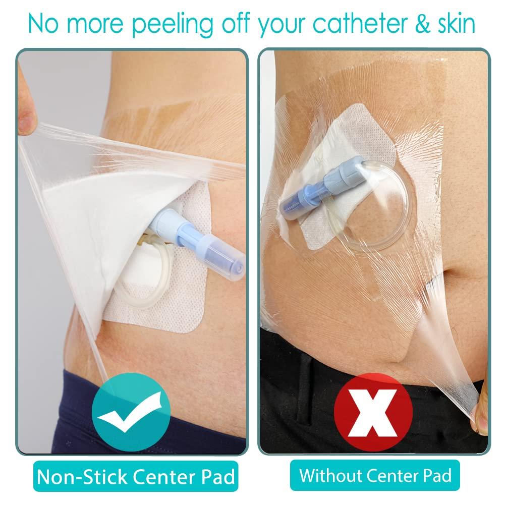 Hola Health Waterproof Shower Cover Shields, Non-Stick Center Pad for Dialysis Port Picc Line Chest Catheter PD Peritoneal Dialysis Chemo Feeding Tube Peg G-Tube Patient Bandage Protector, 8\"x8\"(Pack of 25)