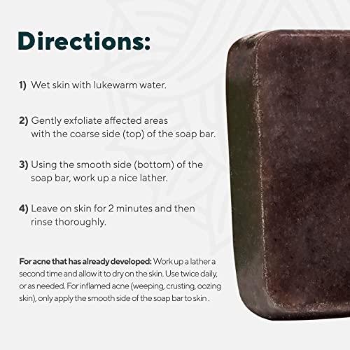 MARIE'S ORIGINAL Marie Originals Acne Bar Soap Cleanser for Face and Body | Acne Treatment with Bentonite Clay, Organic Oat Bran, Noni Fruit Powder, White Willow | Natural Body Wash for Pimples and Scars (1 Pack)