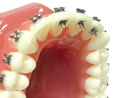 Dentalmall Dentalmall Bite Turbos Opener Lingual Rest Bite-Builder Wing Tongue Tamers Crib 100 Pieces