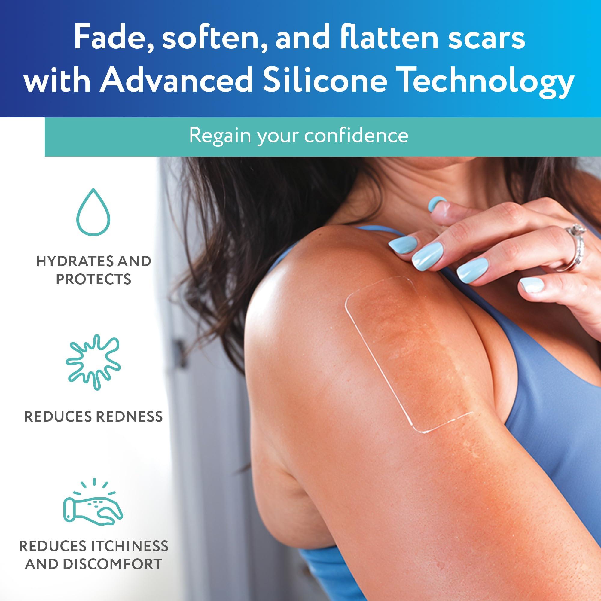 ScarAway ScarAway Advanced Clear Silicone Scar Sheets, Medical Grade Silicone Strips (1.5\" x 3\") Scar Treatment and Prevention for Surgical, Burn, Body, Hypertrophic & Keloid Scar Treatment, 10 Clear Sheets