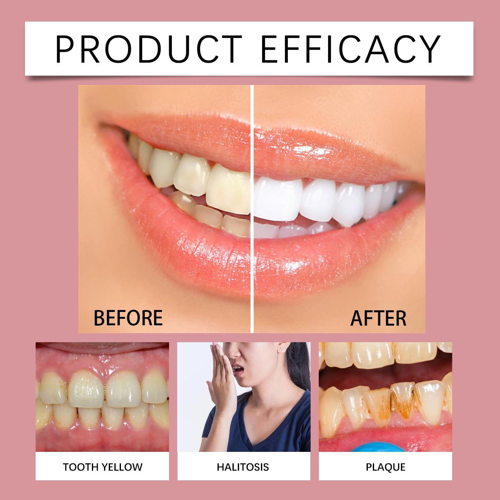 Generic Sp-9 Toothpaste, Sp-9 Ultra Whitening Toothpaste, Sp9 Toothpaste (2pcs)