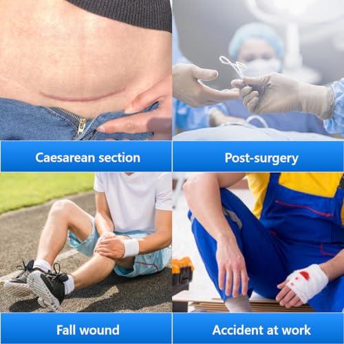 Longmed Longmed Emergency Wound Closures 7.76x2.36 Inch Adhesive Bandages Zip Sutures Butterfly Bandages for C-Section,Keloid, Post Surgery