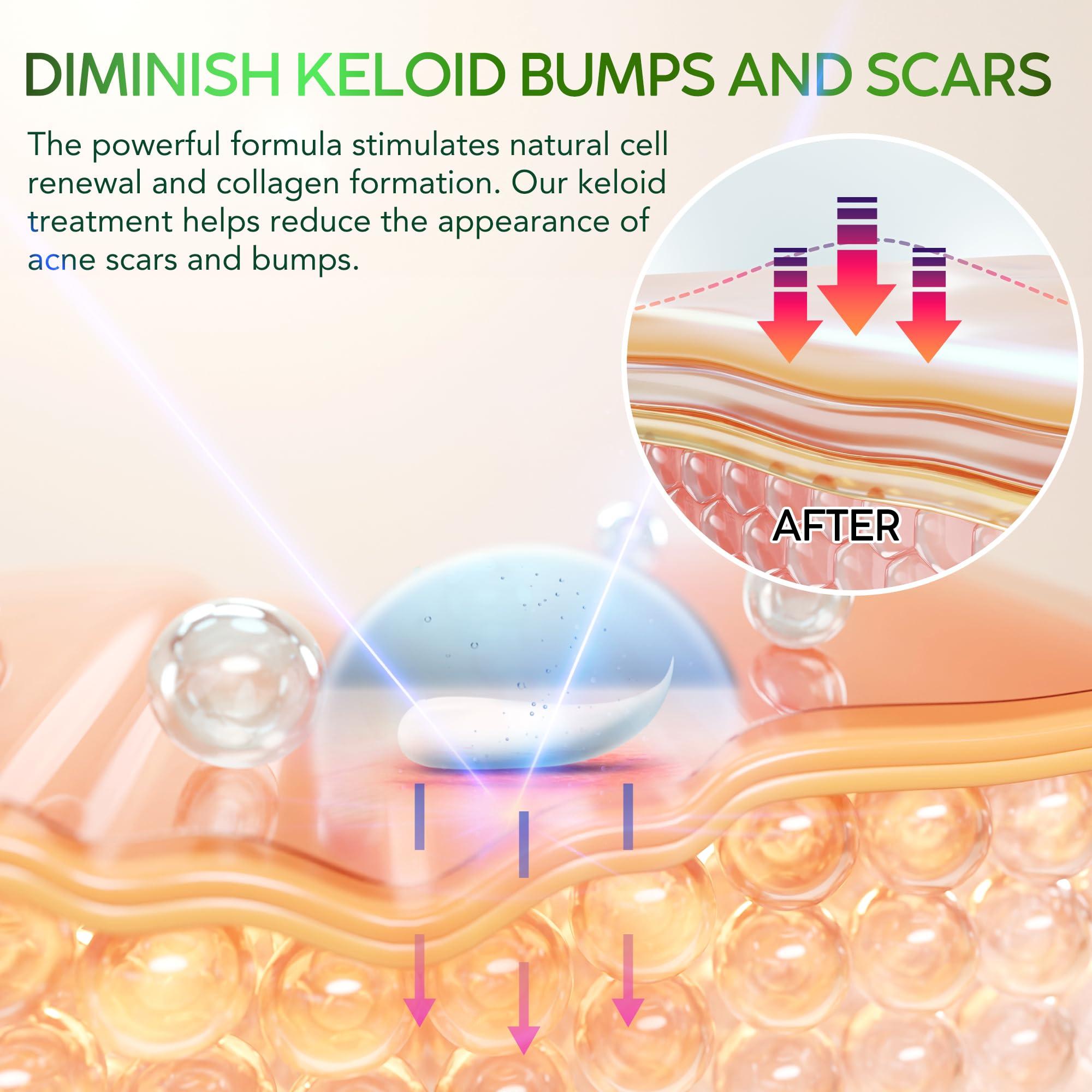 Tobcharm Advanced Keloid Bump Removal Gel: Silicone Keloid Scar Removal Cream for Scars from Piercing, Surgical Marks, Acne, and Burns, Keloid Treatment for Ears, Face, and Body with Healing Formula 30g