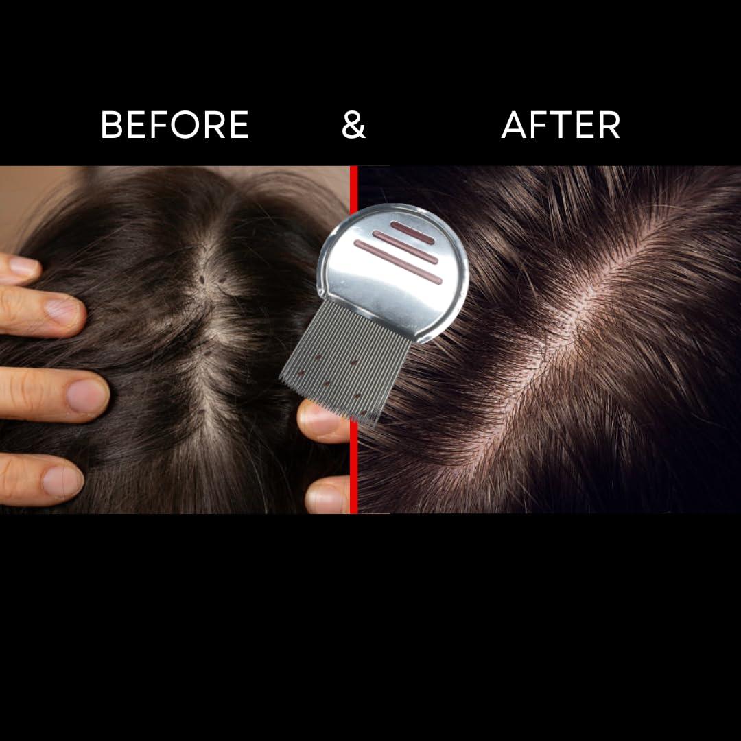 NitKill NitKill 10 Pack Lice Comb