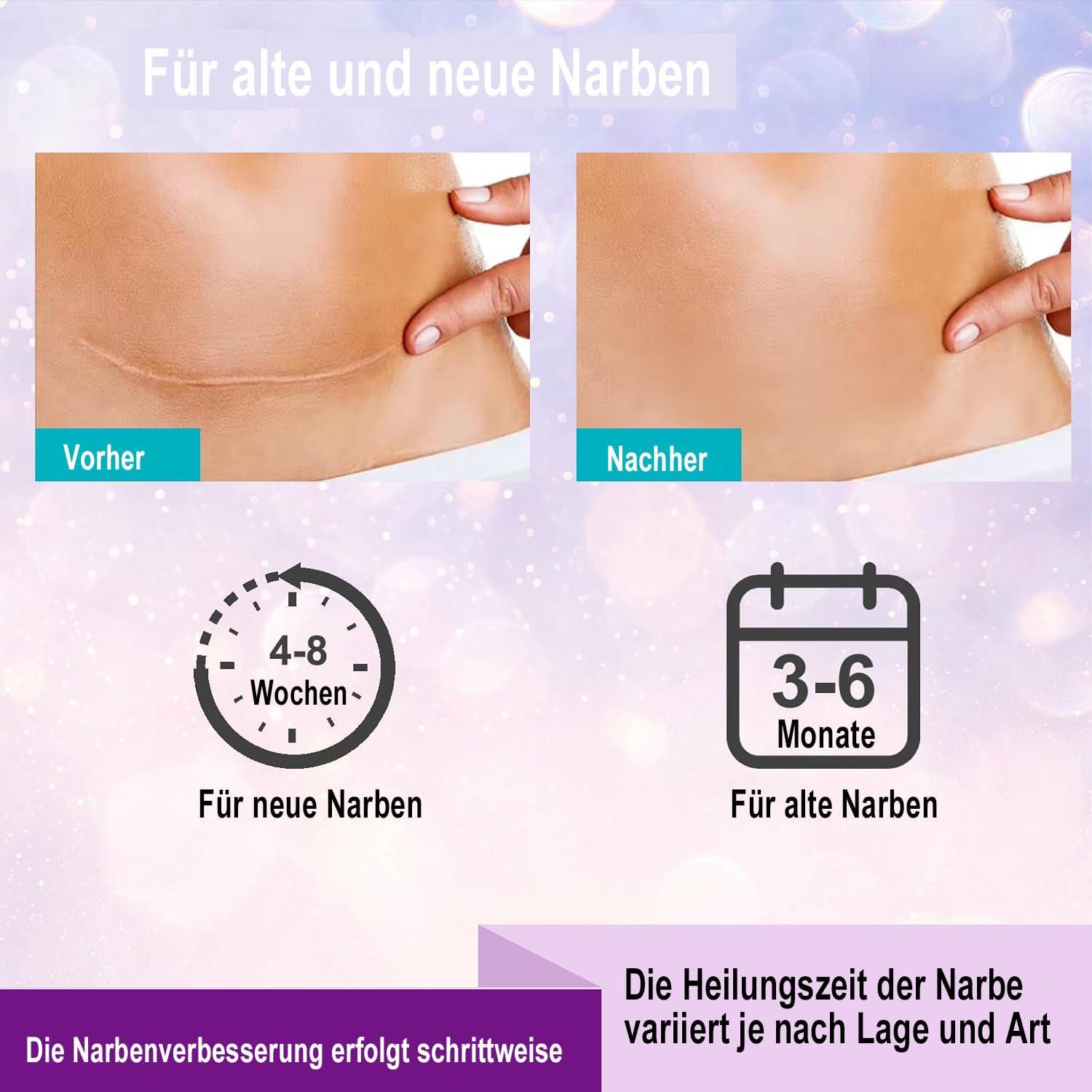Kelinul Silicone Scar Sheets(1.6 x 120\"Roll-3M) Scar Removal Silicone Scar Tape for Softening and Flattening Scars, Acne, C-Section, Keloid Surgery, Painless Removal, Reusable, Washable, 10-12 Month Supply