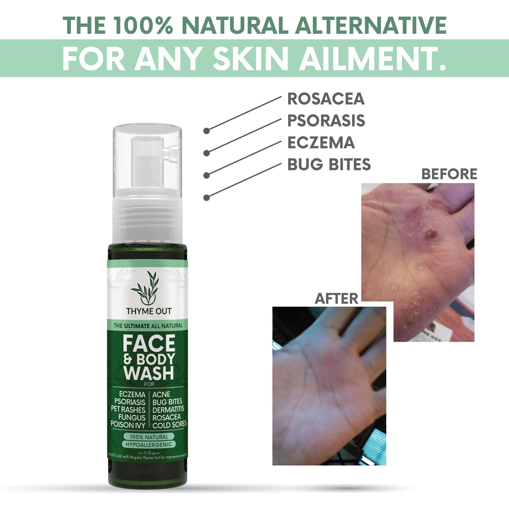 Thyme Out Thyme Out All Natural Face & Body Wash for Eczema, Psoriasis, Pet Rashes, Poison Ivy, Acne, Bug Bites, Dermatitis, Rosacea & Cold Sores - Soothes Itching, and Irritation (7.1 oz)