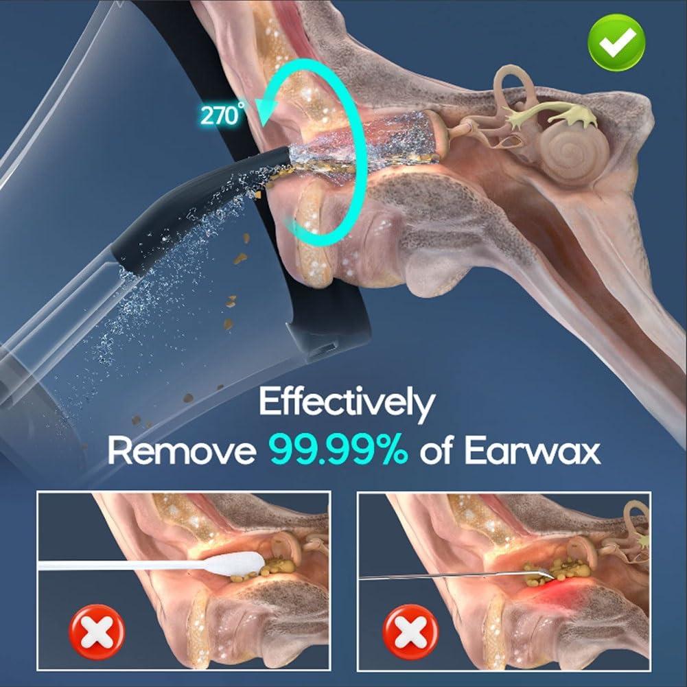 luotts Outfany Earclean Pro, Libiyi Dotmall Ear Cleaning, Dotmall Earwax Cleaning, Electric Ear Cleaner, Welnax Electric Ear Cleaner, Ear Flushing Kit for Adults, Ear Cleaning Machine, Ear Flush(2 Set)