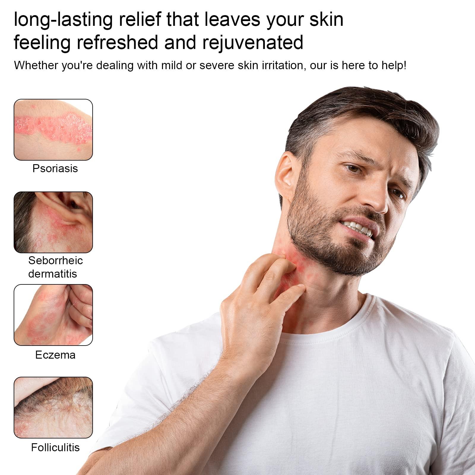 KYMOOU 4 PCS Manuka Honey Tea Tree Drawing Salve Cream Ointment for Boil, Cyst Removal Patch, Splinter Remover, Boil Ease, Ingrown Hair, Chigger, Carbuncle, Pilonidal, Bug, Mosquito, Spider Bites, Bee Sting