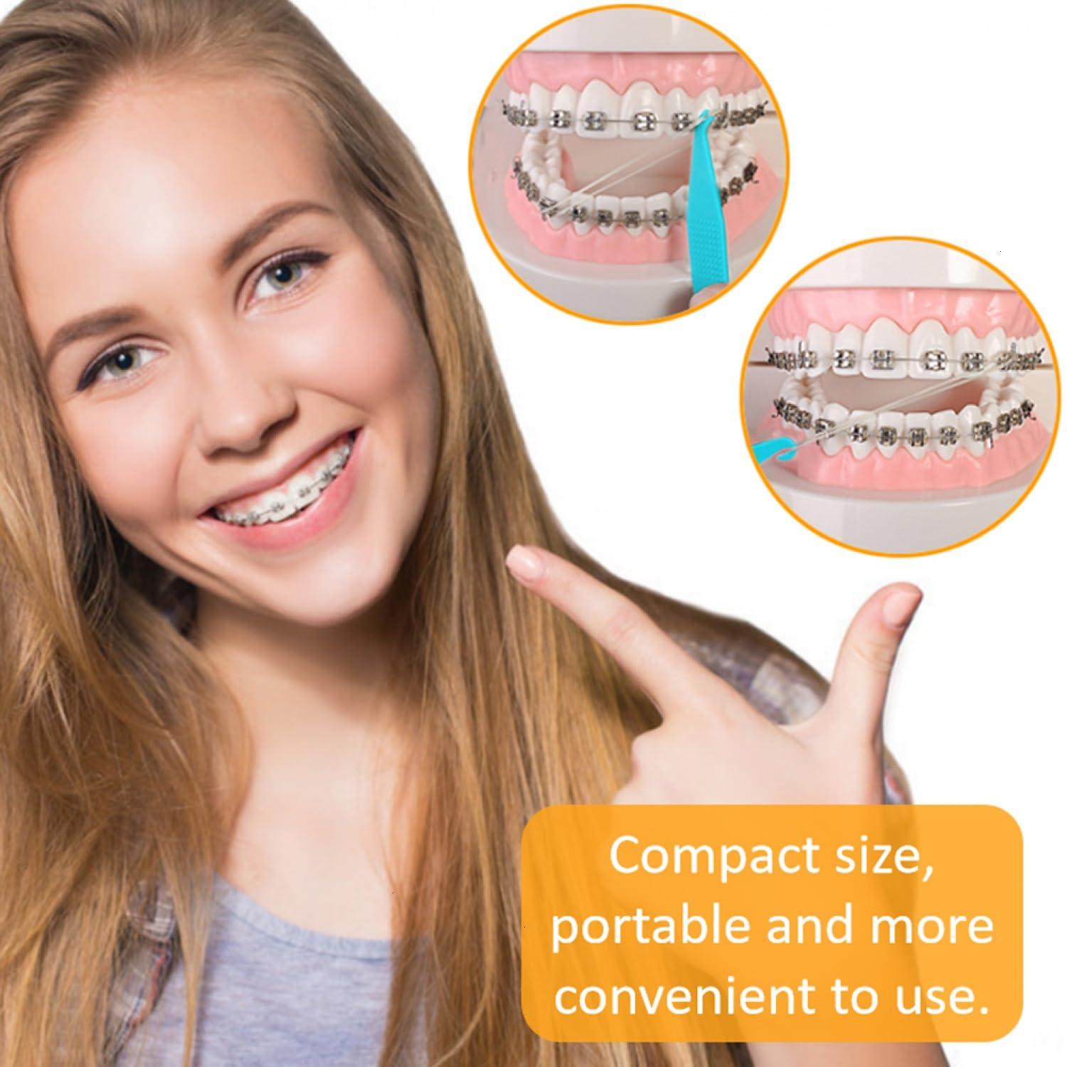 SenseYo SenseYo 200 Pcs Colorful Dental Elastic Braces Rubber Band Tool for Orthodontic Braces