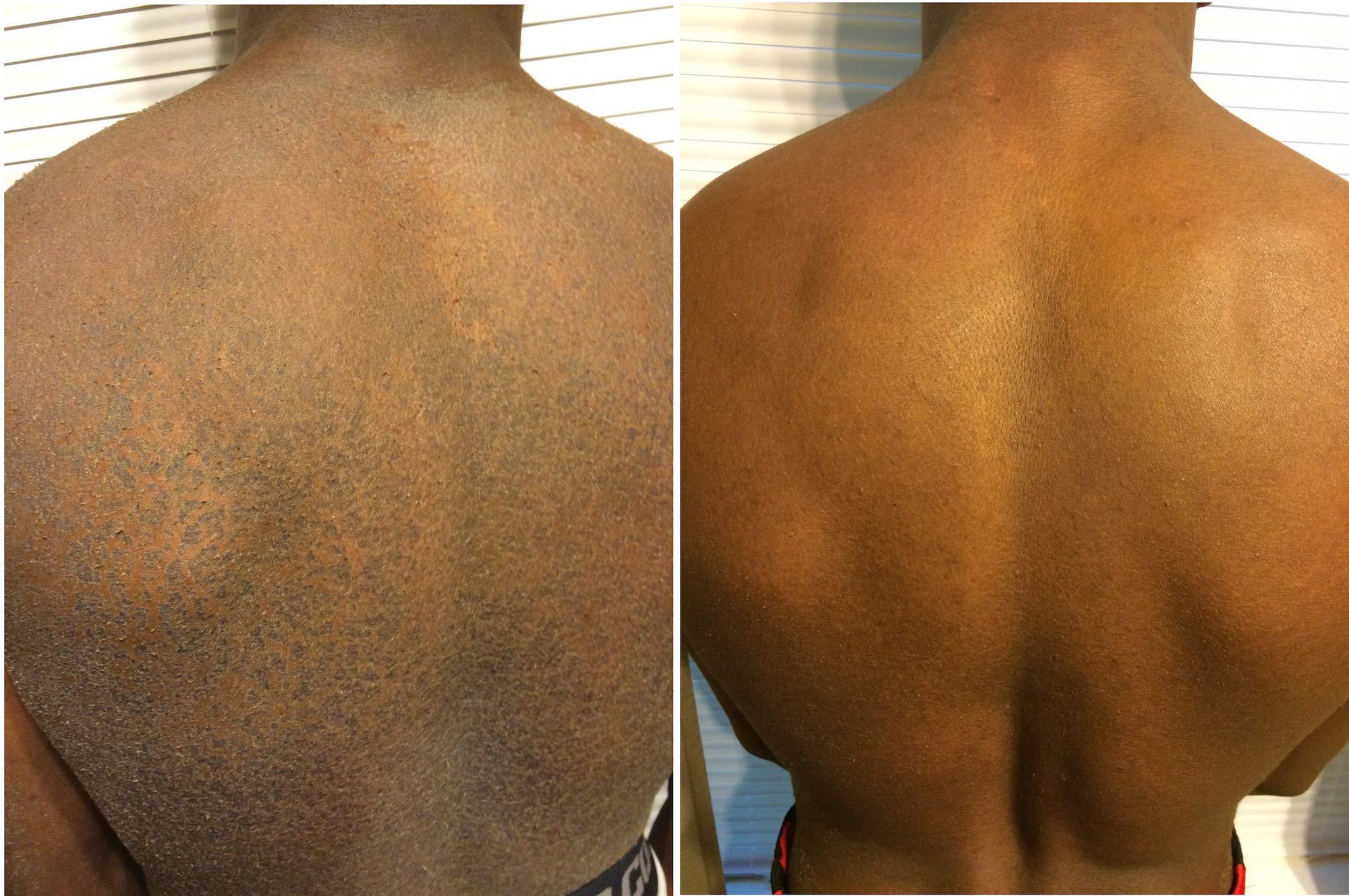 G16 Lotion G16 Skin Repair, Very Dry Skin & Ichthyosis Treatment Cream & Lotion