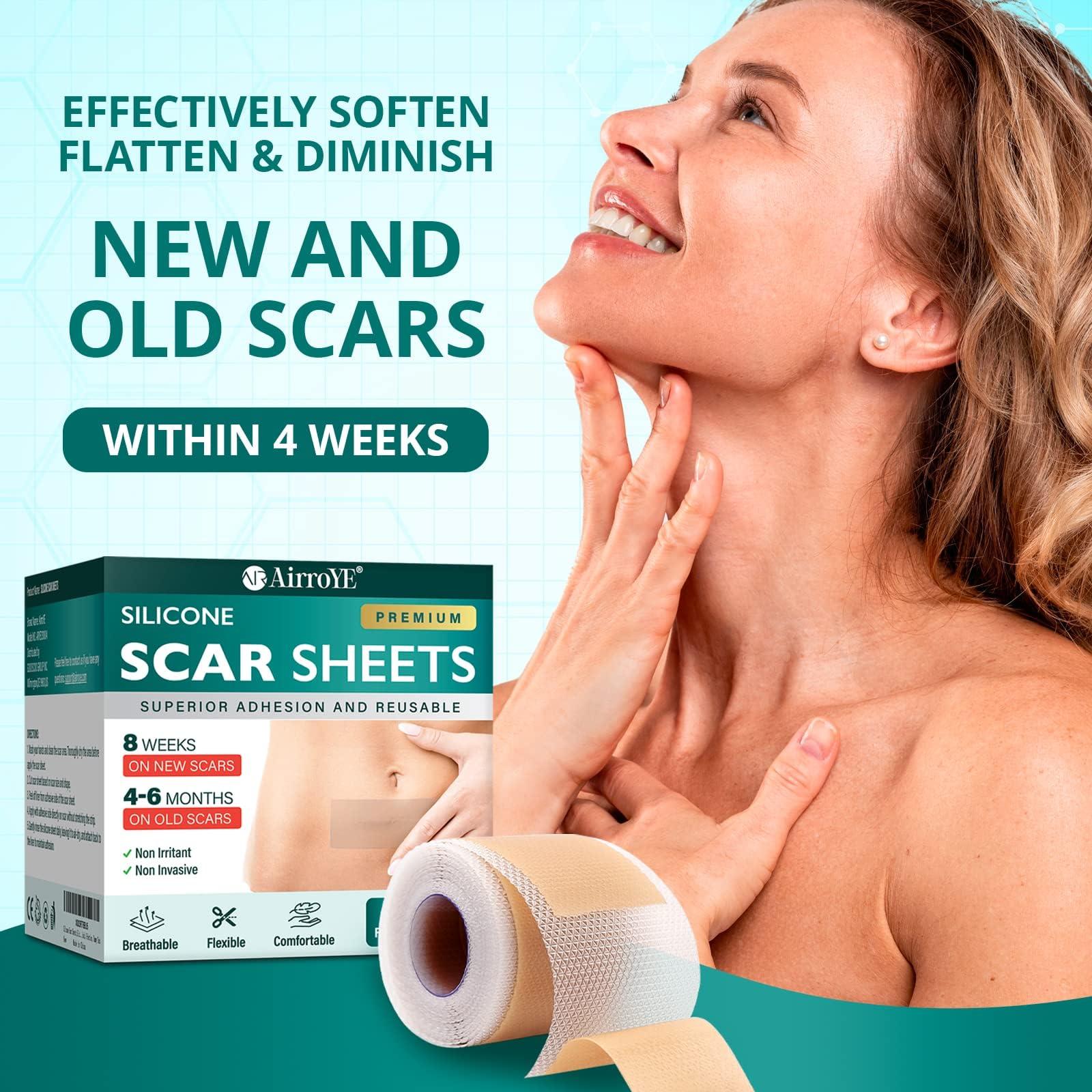 AirroYE Silicone Scar Sheets,Silicone Scar Tape(1.6\"x 60\" Roll-1.5M), Reusable And Effective Scar Removal Sheets, Silicone Scar Removal Sheets For Surgical Scars,Healing Keloid, C-Section, Tummy Tuck