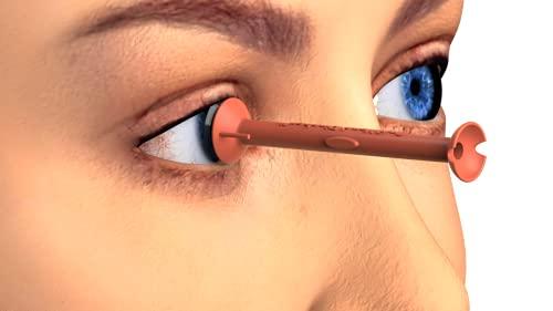 OptiWand OptiWand Pincher Soft Contact Lens Inserting Removing Tool. Helper to Pinch Eye Lenses for Removal. Applicator Inserter Remover Extractor Device. Gift Eyes Contacts Insertion Removal Solution Stick