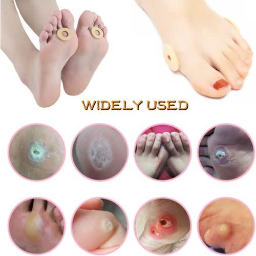 MYMULIKE Corn Pads for Toes Soft Foam Callus Cushions Corn Cushion Pads Self Stick Adhesive Foot Care Cushions Waterproof Corn Protectors for Feet Women Men