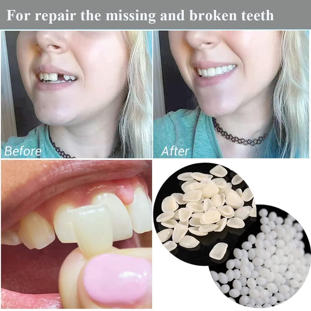 Healthyare Tooth Repair Kit-Thermal Fitting Beads Granules and Fake Teeth for Fixing Missing and Broken Tooth
