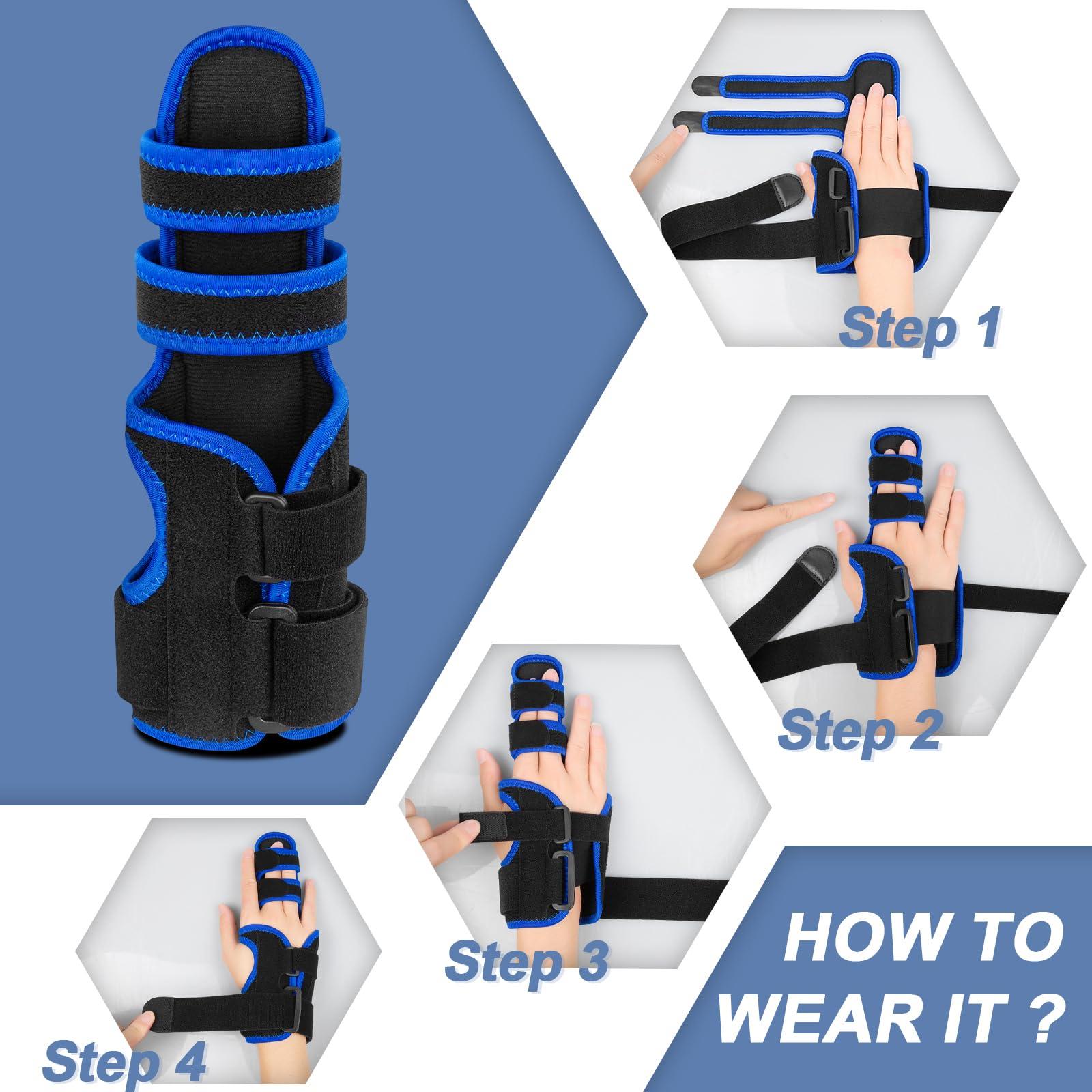 TISMOD TISMOD Trigger Finger Splint: Support the Middle, Index, little or Ring Finger, Hand Splint Brace-Treating Hand Fractures, Arthritis, Mallet Finger or Metacarpal Fractures (Left Hand)