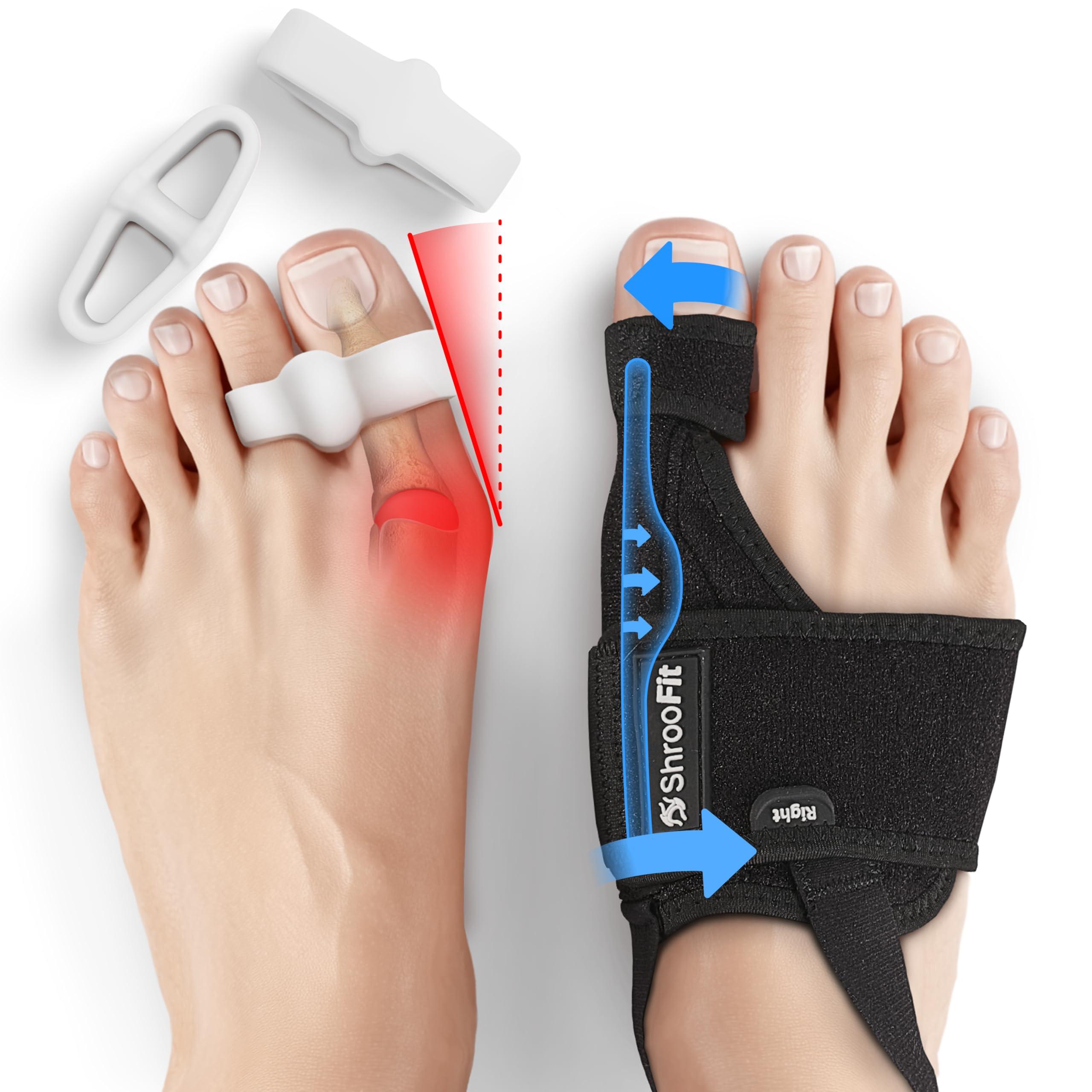 ShrooFit Effective Bunion Corrector for Women and Men | Relieve Pain, Straighten Toes, and Correct Bunions | Orthopedic Toe Straightener | Best Bunion Corrector for Lasting Relief