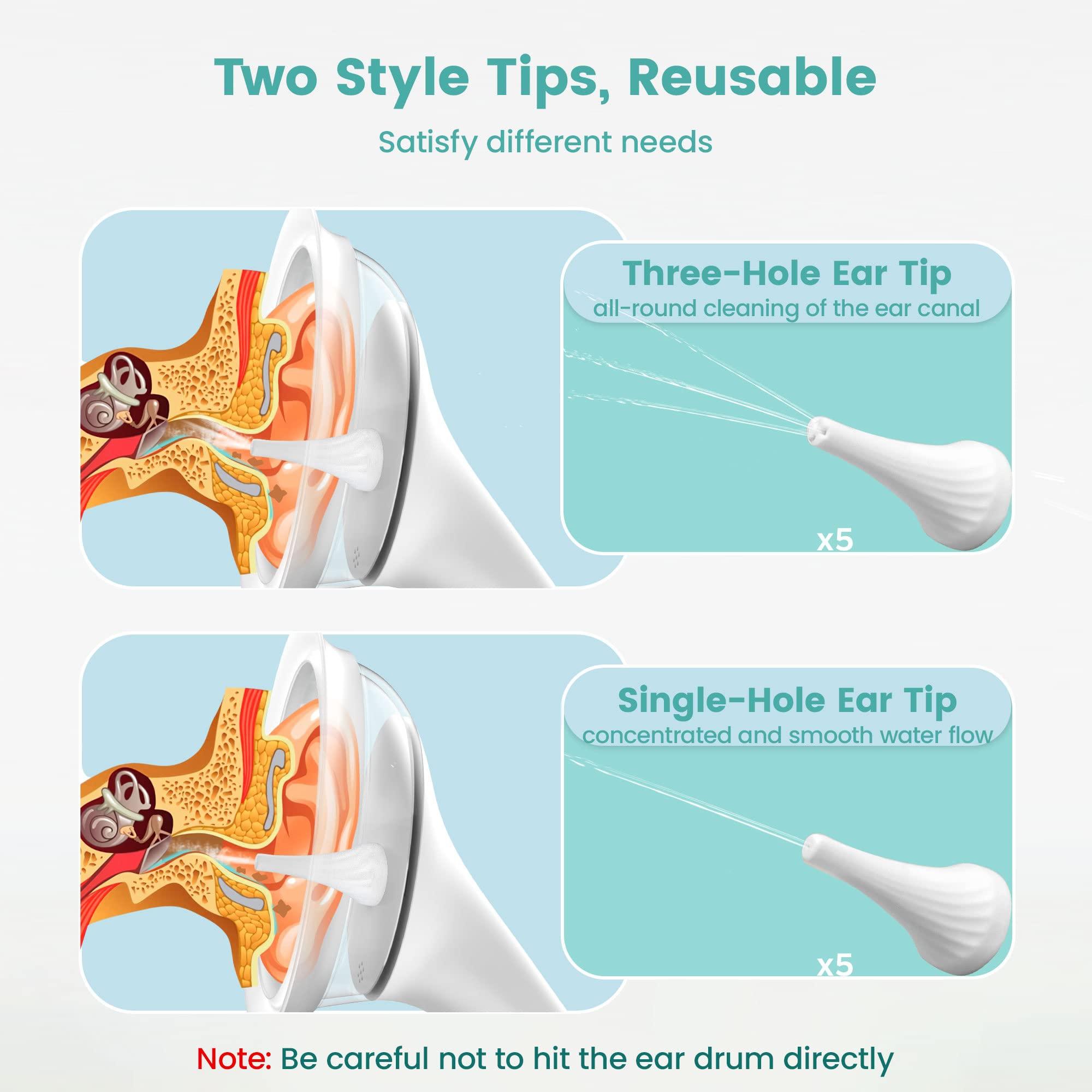 momspeace Electric Ear Wax Removal Ear Cleaner, Safe & Effective Ear Wax Removal Kit, Momspeace Ear Cleaning Kit with Automatic Sewage System, 4 Pressure Settings, 10 Tips, Ear Irrigation Ear Wax Removal Tool