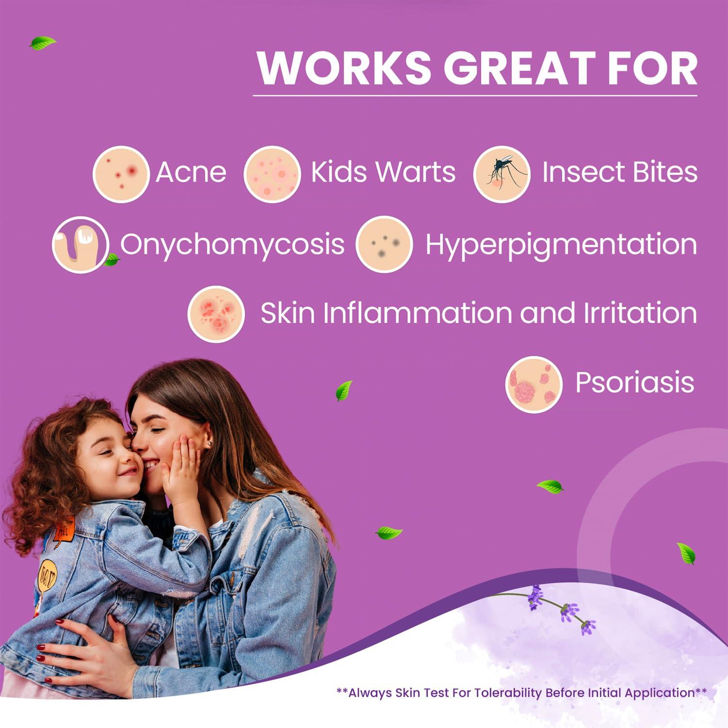 Naturasil Naturasil 10% Sulfur Lavender Soap Bar Natural Skin Treatment for Acne, Bug Bites, Warts Treatment, Viral Bumps, Nodes & Itching | for Kids & Adults |113 grams