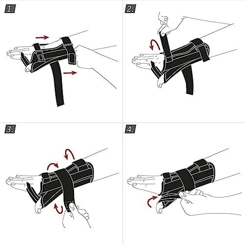 Actimove Actimove Professional Manus Forte Plus Wrist Support & Thumb Brace | Wrist Splint for Arthrosis, Rheumatoid Arthritis, Sprains, Tendon, Soft Tissue & Ligament Injuries, Postoperative Care | Black, Left, X-Small