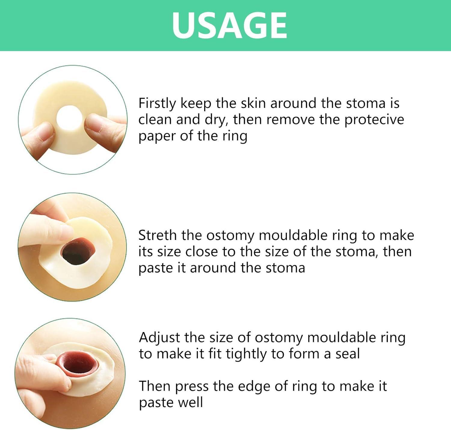 Cisila 10pcs Ostomy Barrier Ring Moldable Ostomy Rings 45mm 4mm Thickness Diameter No Leaking Barrier Extenders for Colostomy Bags Barrier Rings for Stoma, Ostomy Supplies, Elastic & Adapt