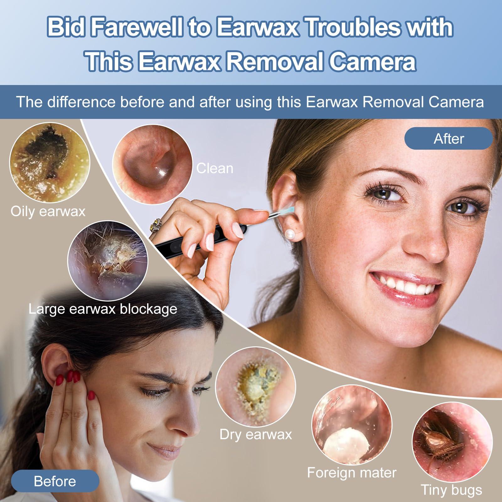 Healthappy Ear Wax Removal, Ear Cleaner with 1080P HD Camera, with 6 LED Lights/IP67 Waterproof Lens/8 Traditional Tools Ear Wax Removal Kit, Rechargeable Ear Cleaning kit for iOS, Android, Tablet (Black)