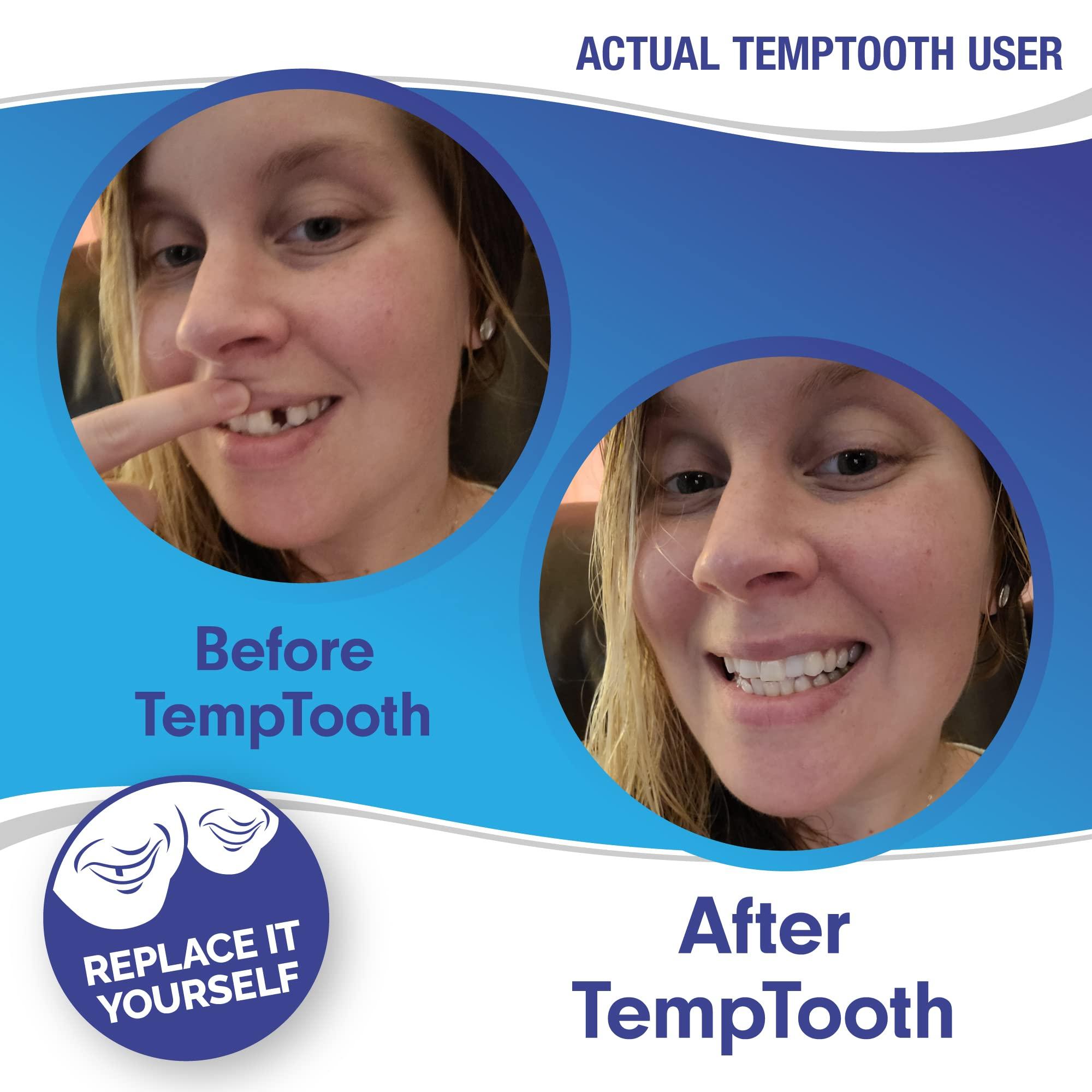 Temptooth Temptooth #1 Seller Trusted Patented Temporary Tooth Replacement Product
