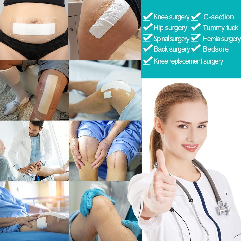 EaseCare C-Section Waterproof Abdominal Incision Bandages Post Hysterectomy Tummy Tuck Shower Protector Scar Cover with Protective Pad Patches Island Dressing Tapes Large Wound Care Supplies 4x12 Pack of 25