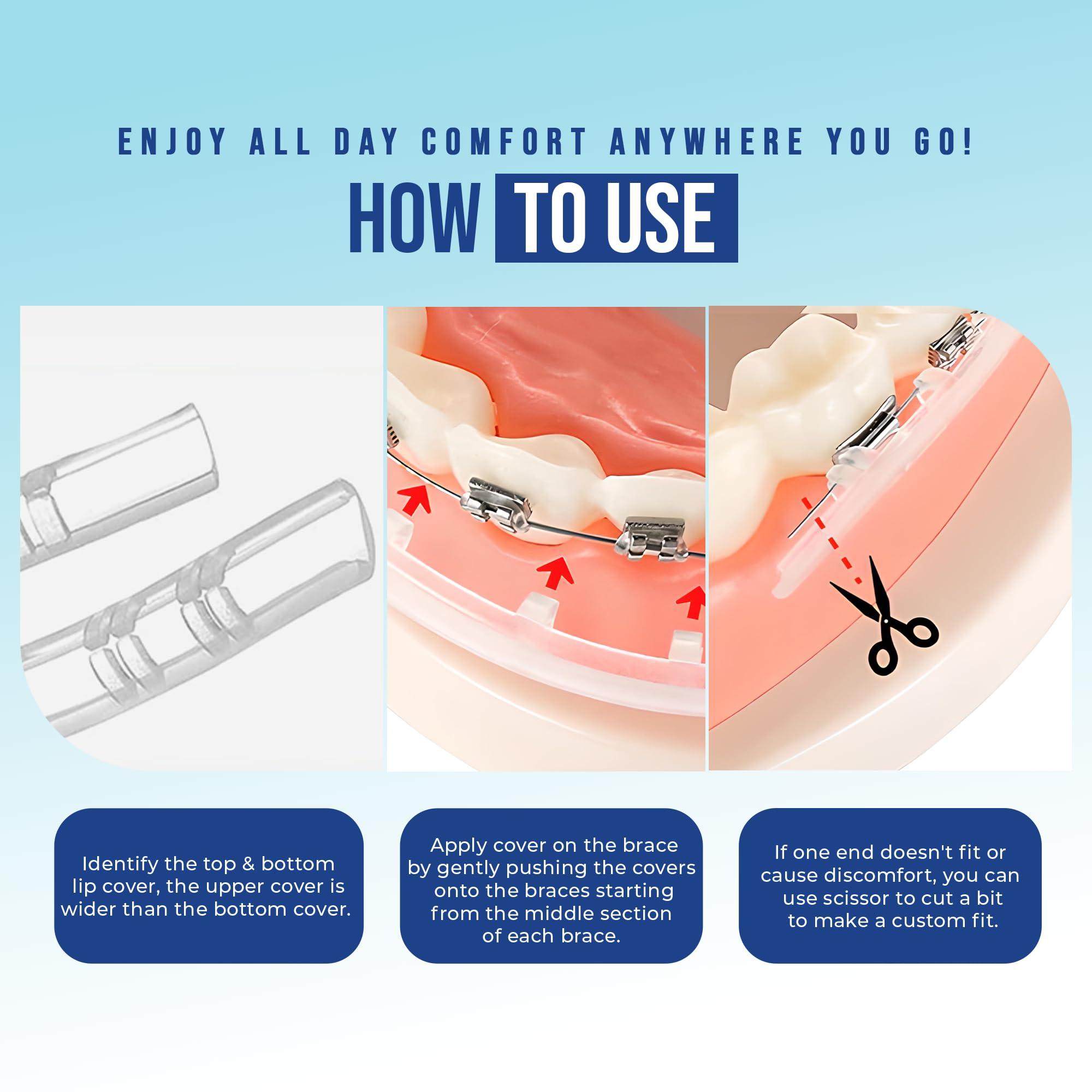 ELEMENT Comfort Cover Braces Guard/Lip and Mouth Protector - Snap on Cover Strip for Braces - Orthodontic/Dental Quality (Clear)