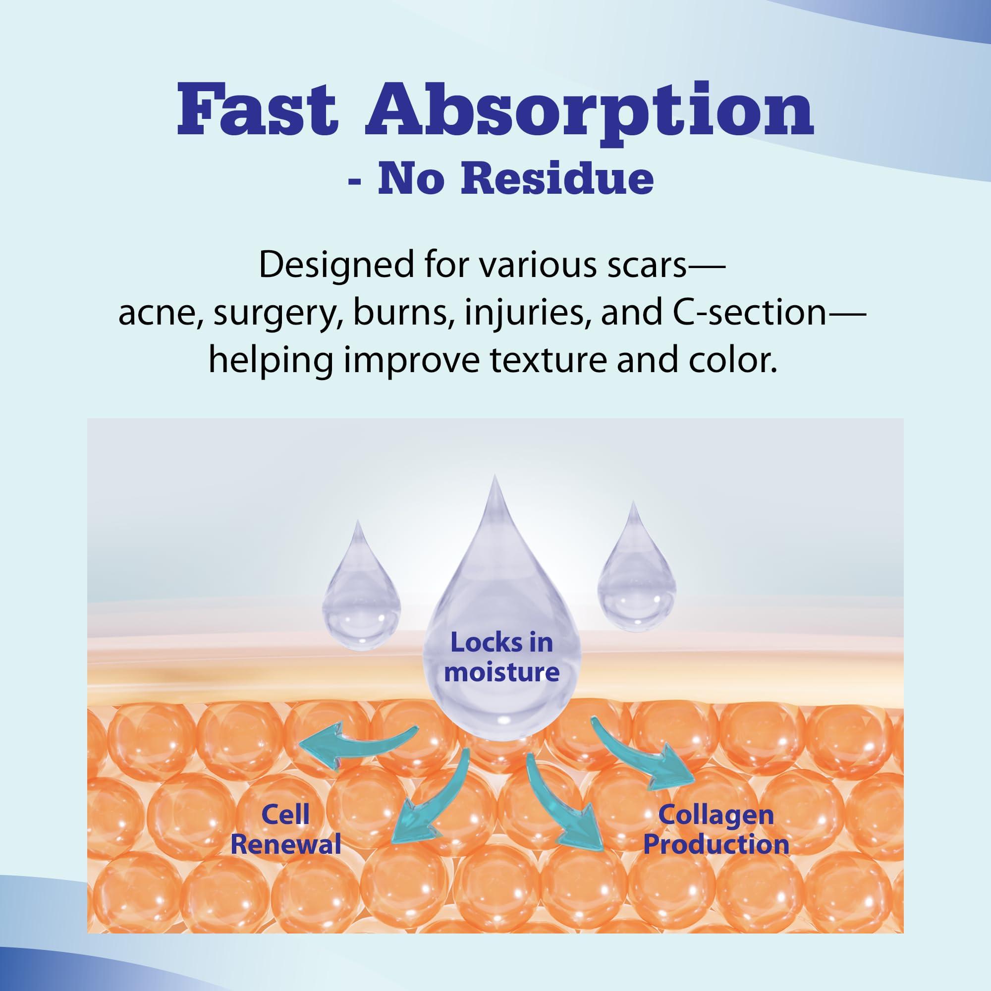 Aroamas Scar Aroamas Scar Advanced Scar Gel - Medical-Grade Silicone Scar Gel for Surgical Scars, for Face, Scar gel with silicone for Keloids, C-Section, Cosmetic Procedures, Burns, Injuries - 45g