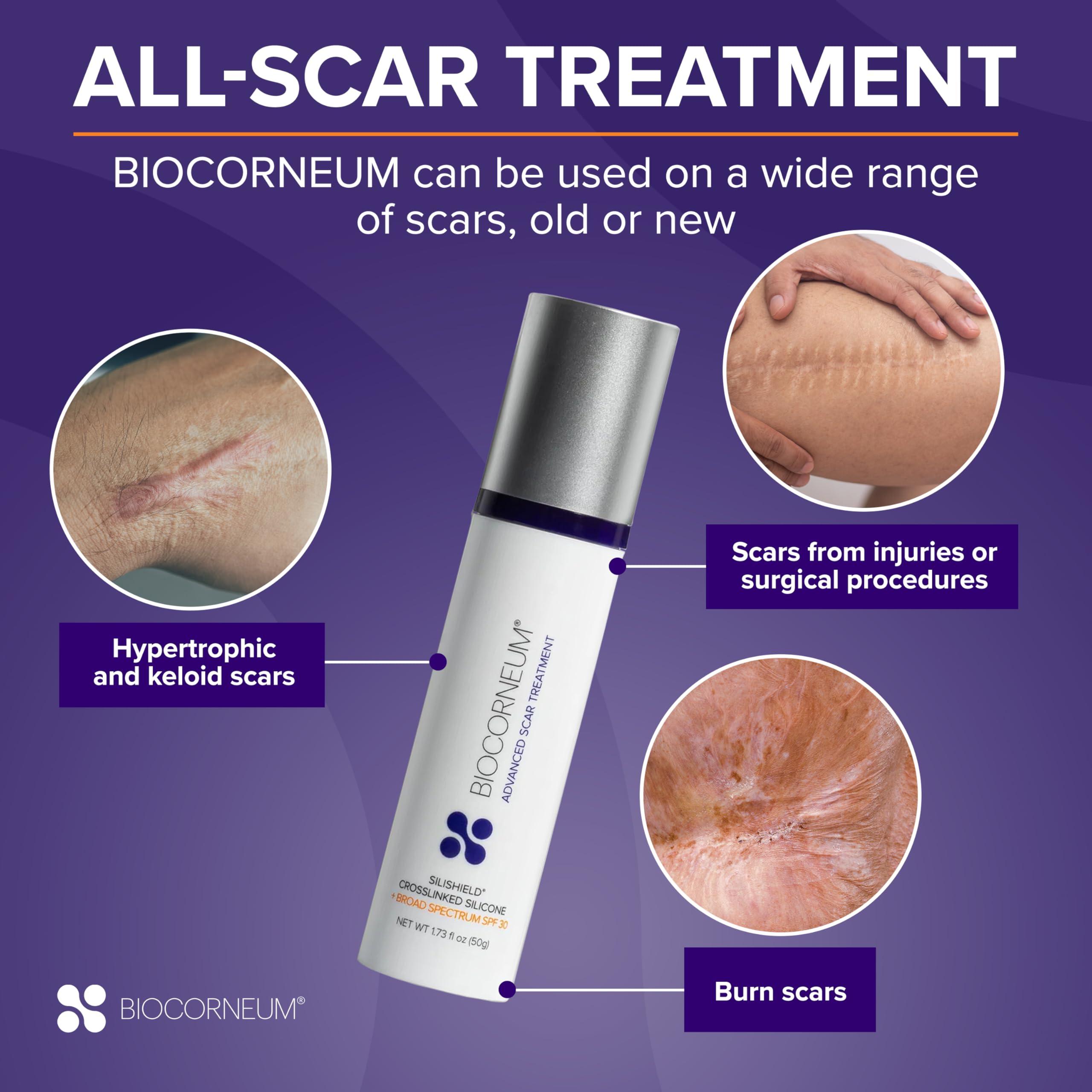 BIOCORNEUM Advanced Scar Treatment with Silishield & SPF 30 50g  Made in the USA, Fast-Drying, Water-Resistant Silicone Scar Gel - Surgeon Recommended for New & Old Scars - Suitable for Children Over 6 Months